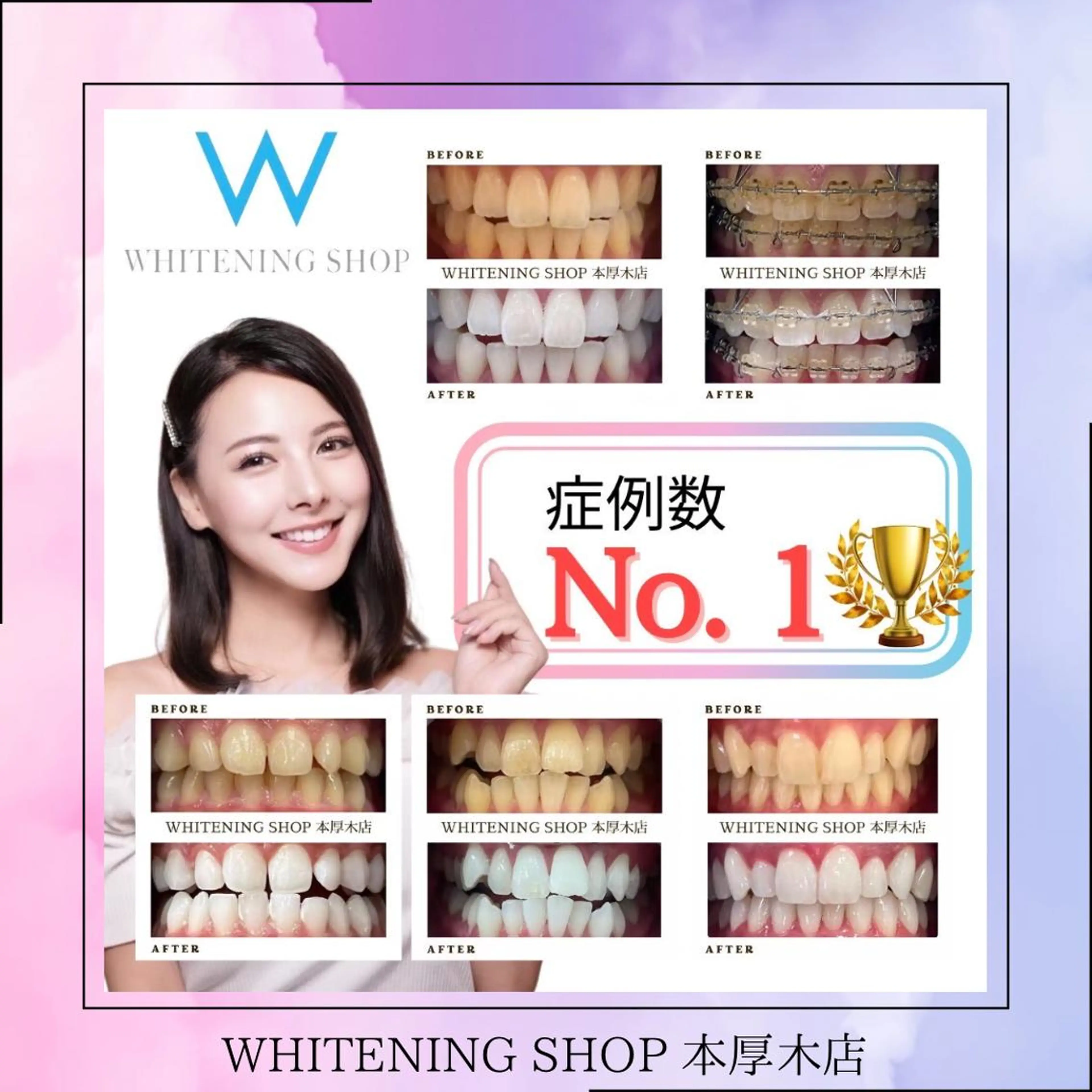 メンズ その他 ホワイトニング ショップ本厚木のその他イメージ