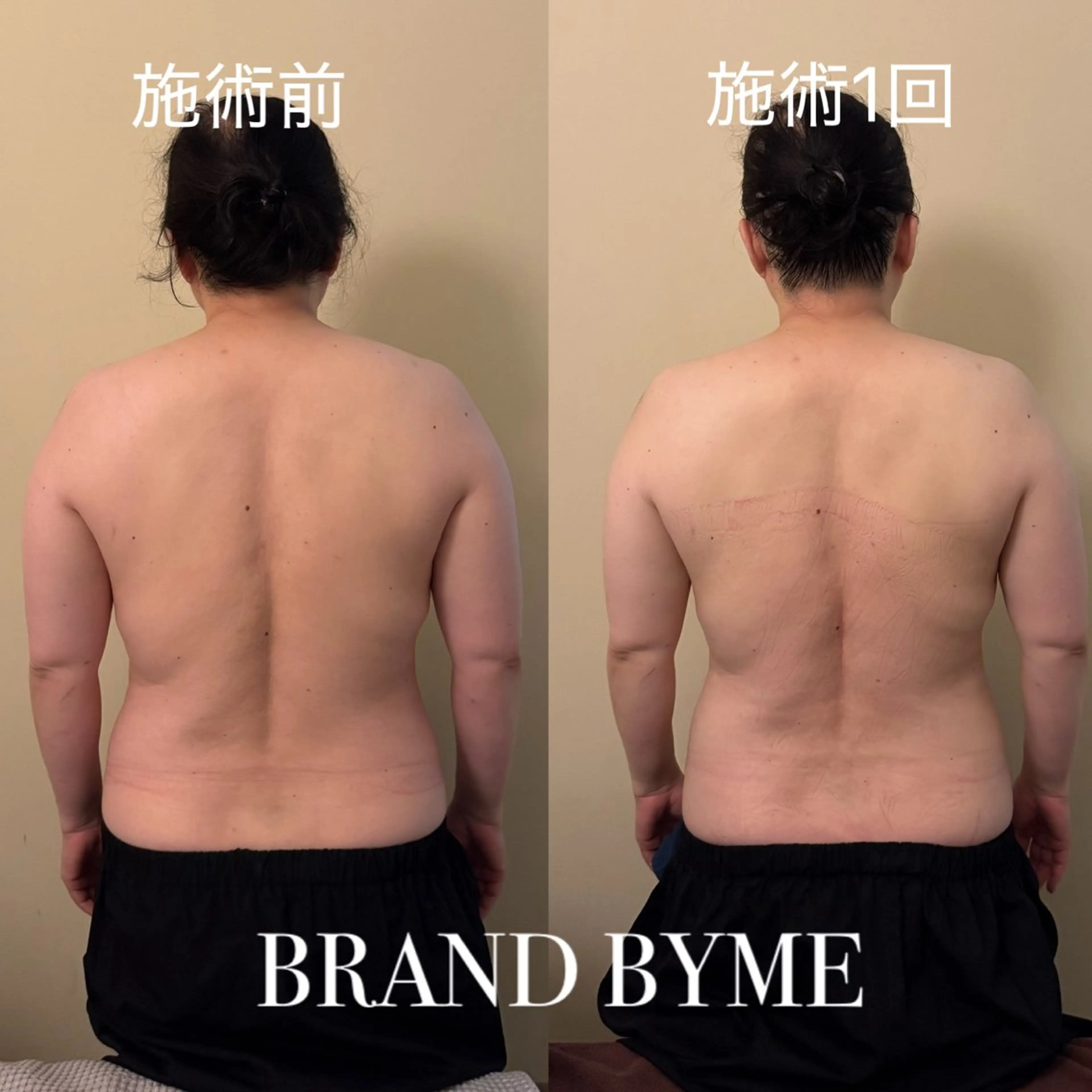 Brand byme 上野店のエステ・リラクイメージ