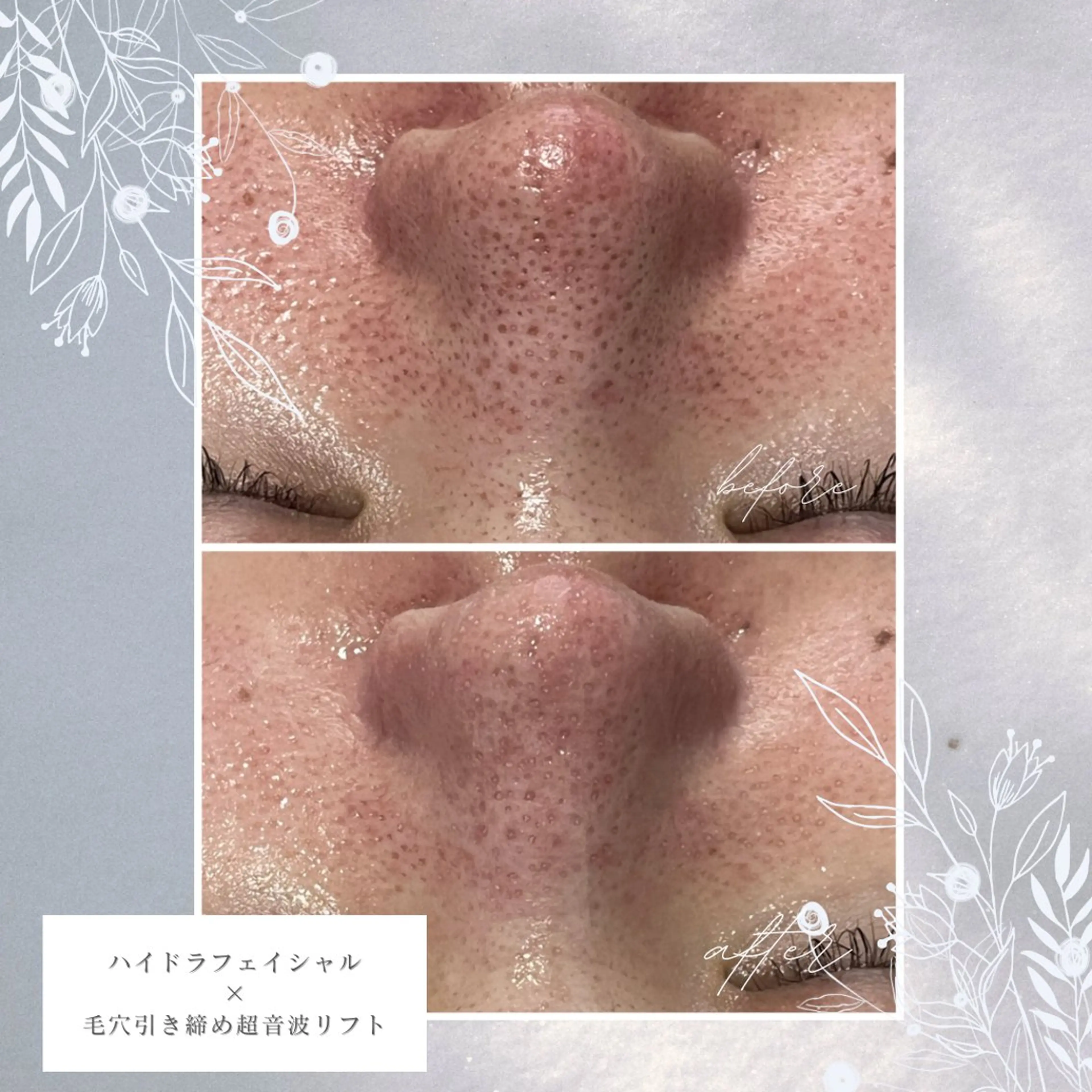 ENCHANT Kaede/肌質改善のその他イメージ