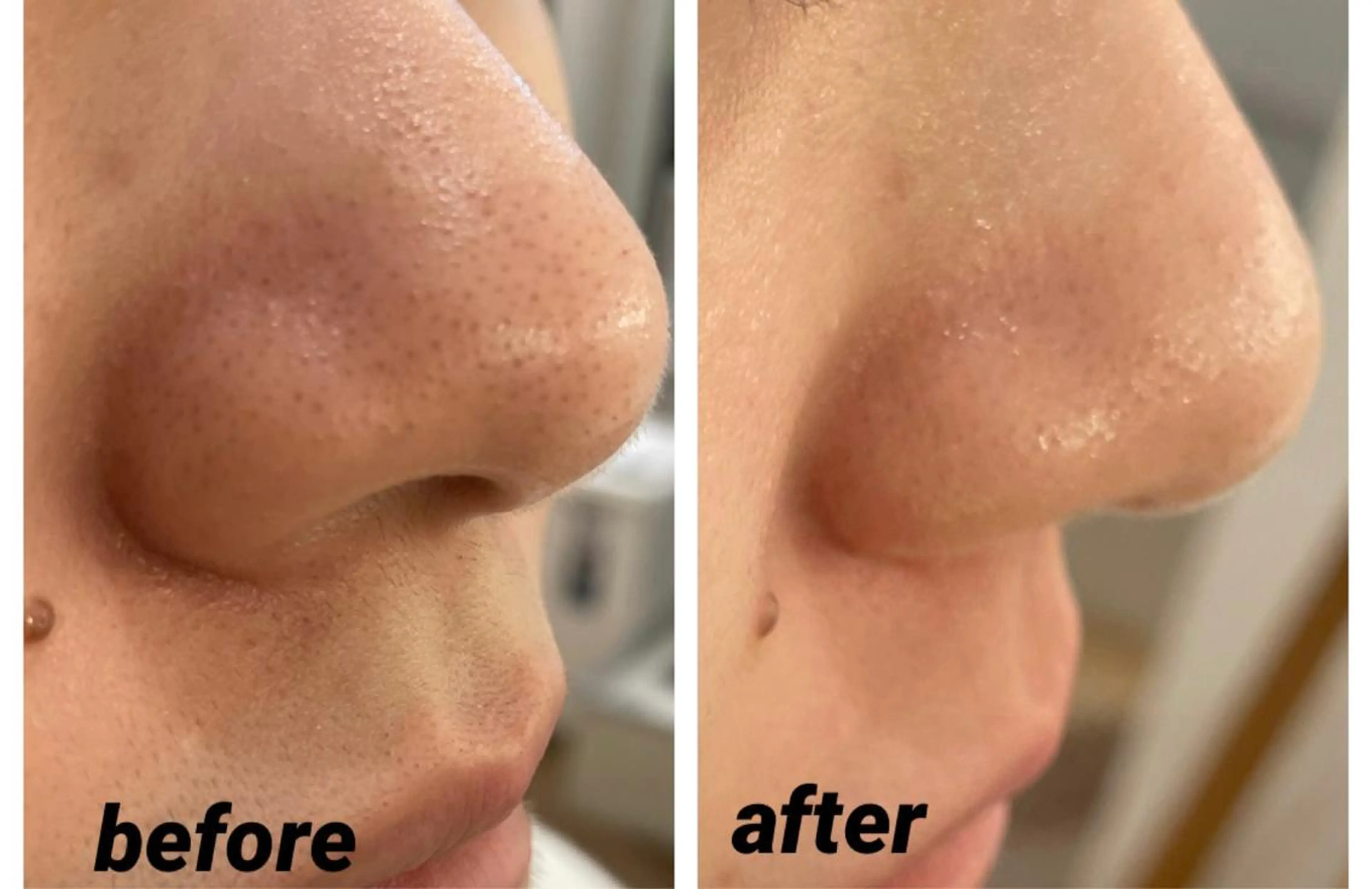 エステ DeI'm   名古屋栄所属・小林 玲菜のエステ・リラクイメージ