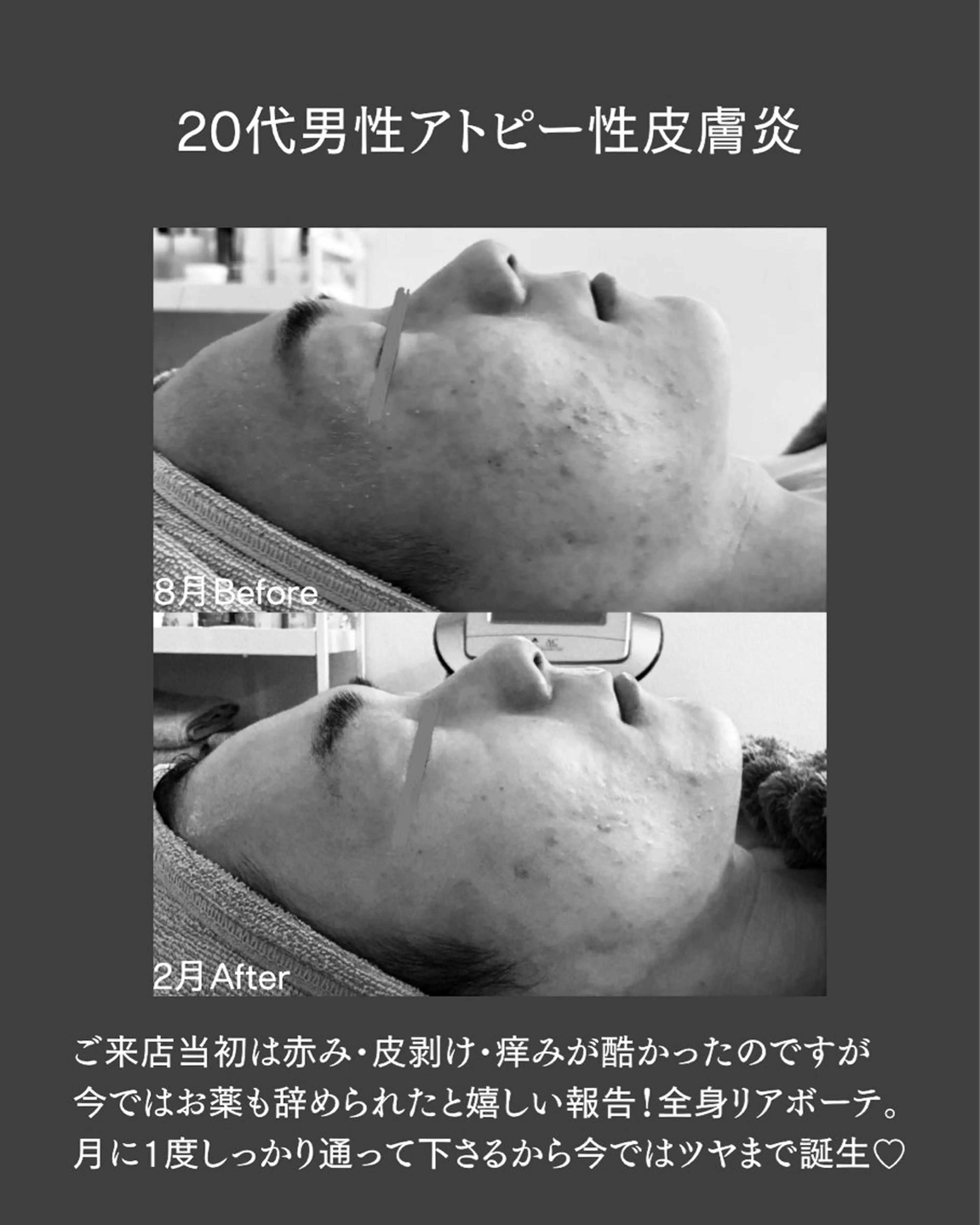 BLOSSOM 菊地のエステ・リラクイメージ