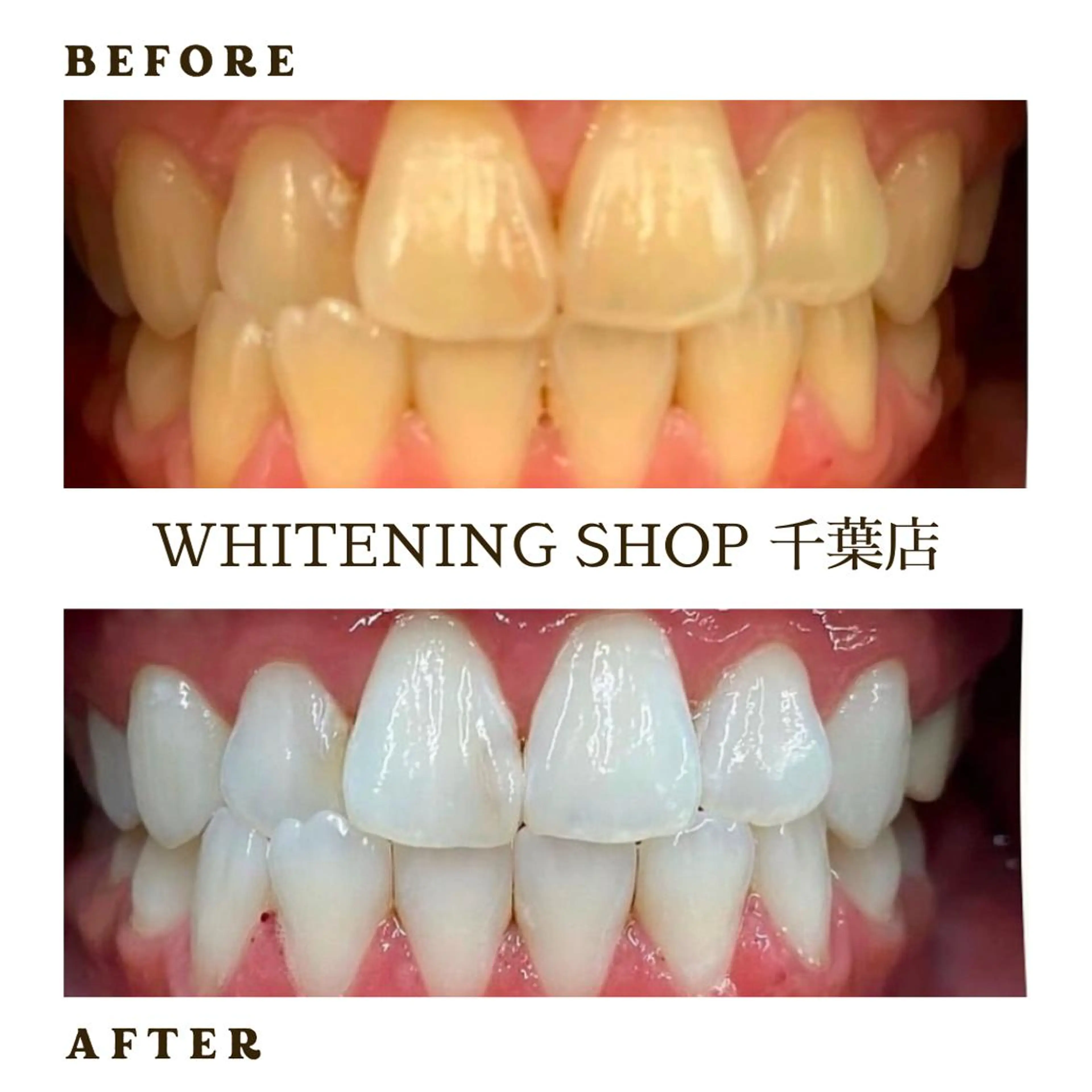 メンズ エステ ホワイトニング ショップ千葉店のその他イメージ