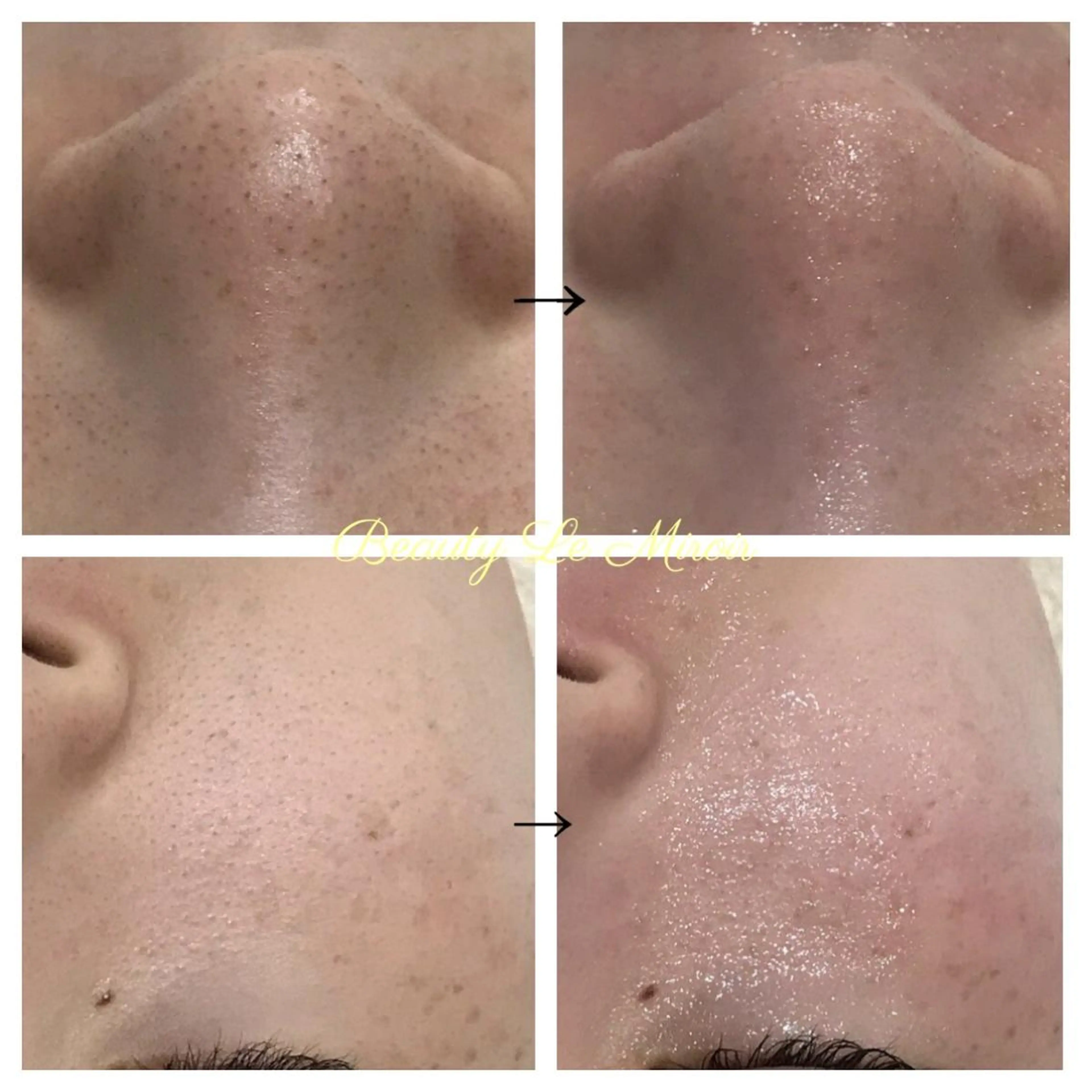 ビューティー ミロワールのエステ・リラクイメージ