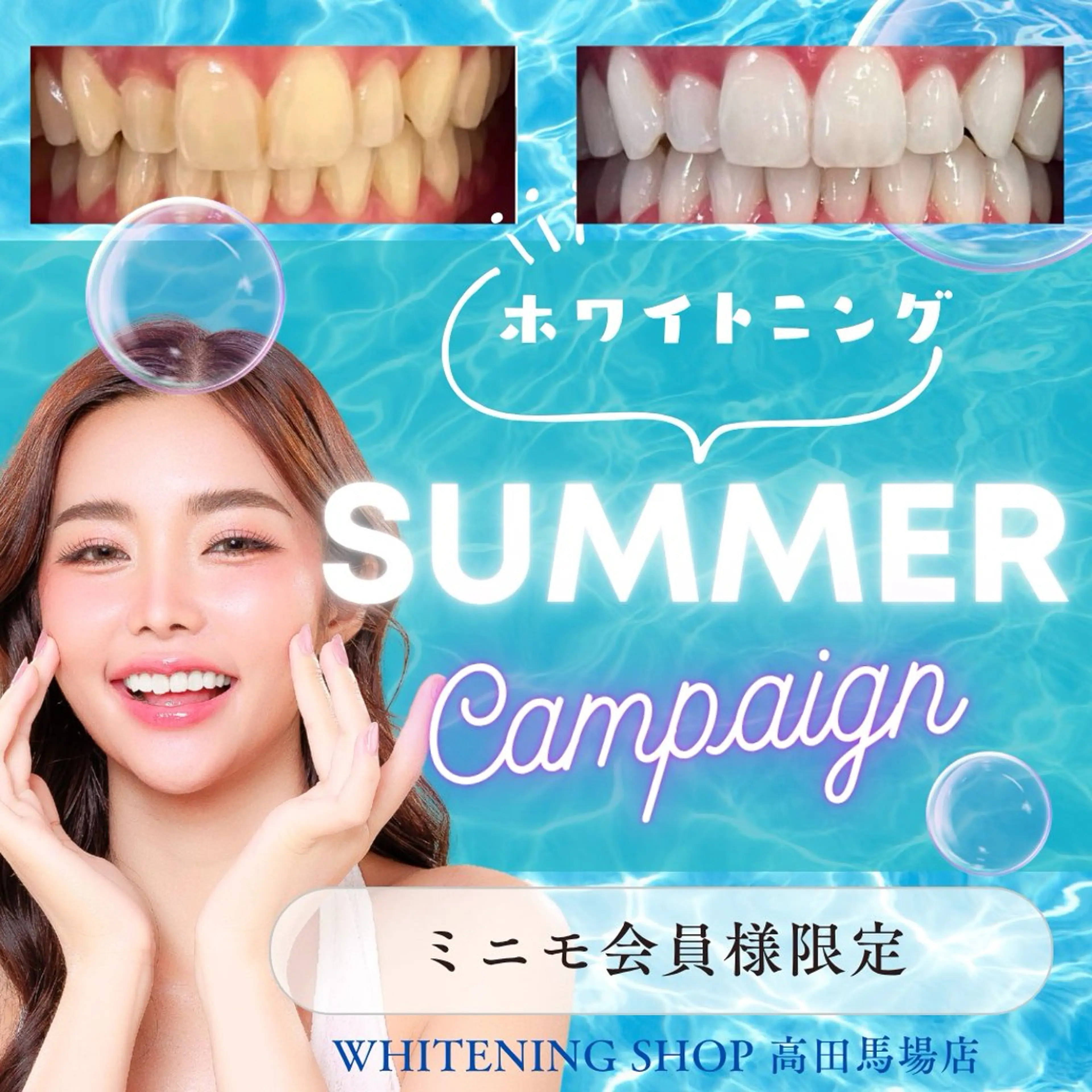 メンズ その他 ホワイトニング ショップ高田馬場店のその他イメージ