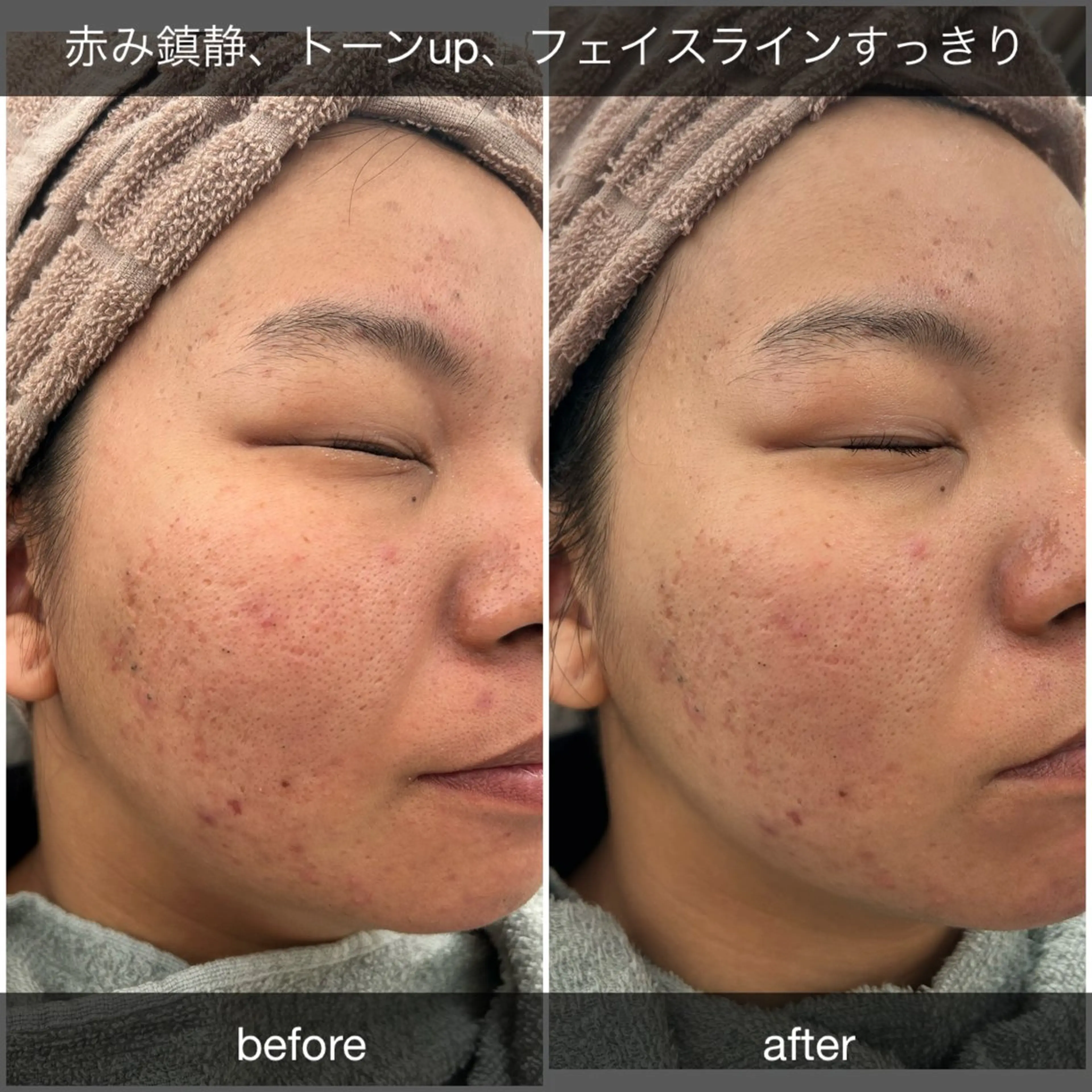 エステ プレジール所属・ビューティサロン プレジールOTAKEのエステ・リラクイメージ