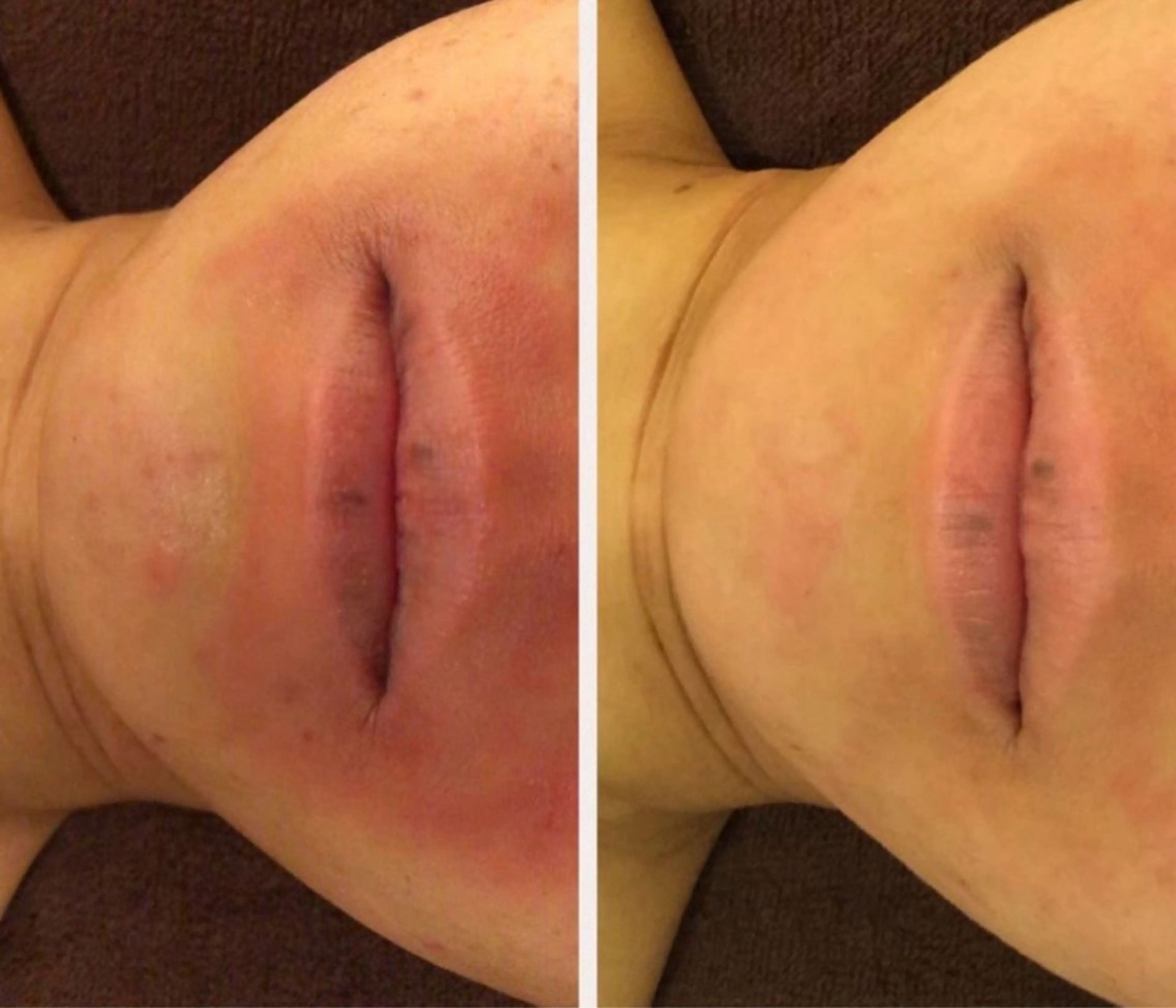 学生ニキビ改善🍀 優しい肌質改善のエステ・リラクイメージ