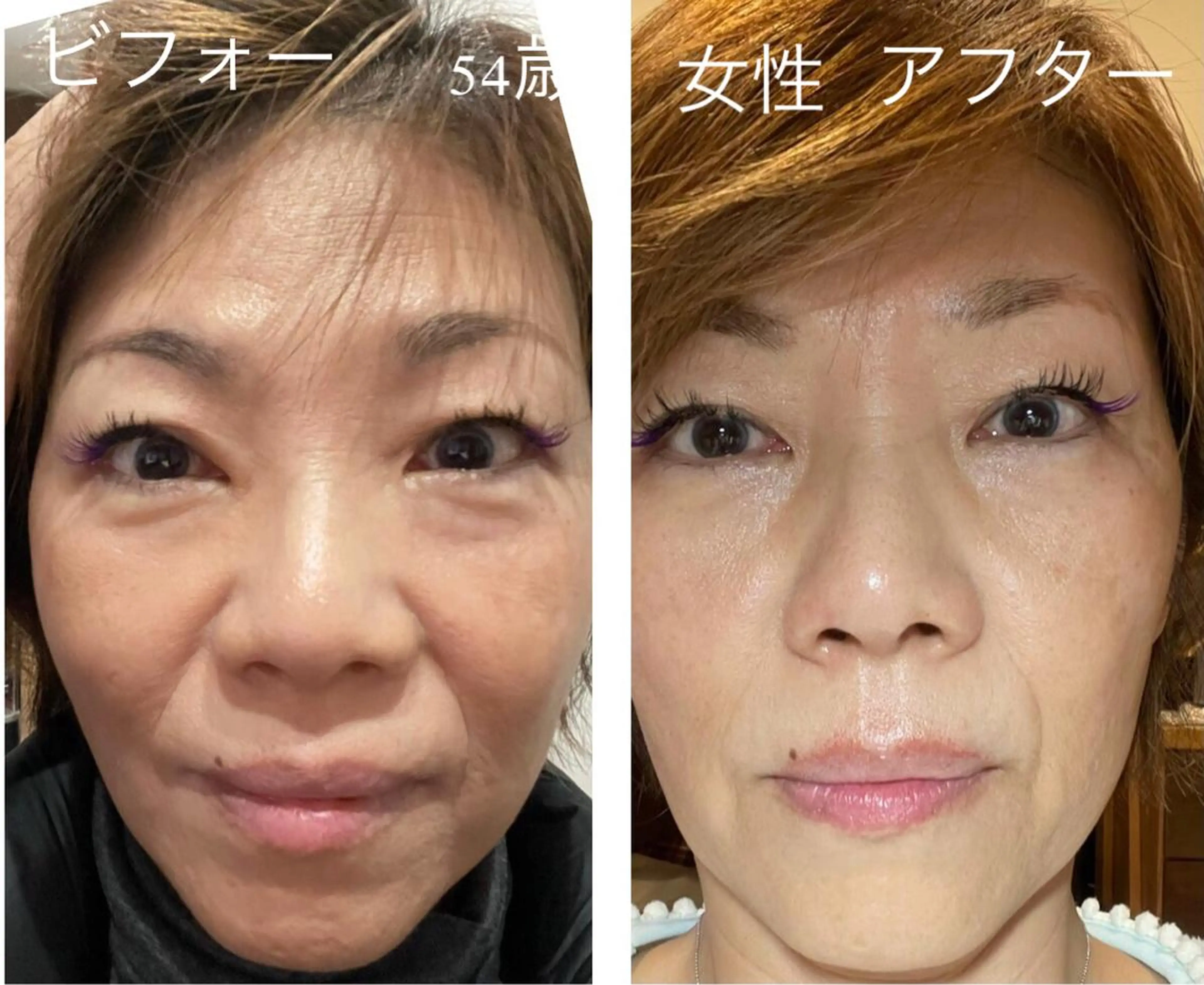 リオッサ  オブ ラグーン神戸店のエステ・リラクイメージ