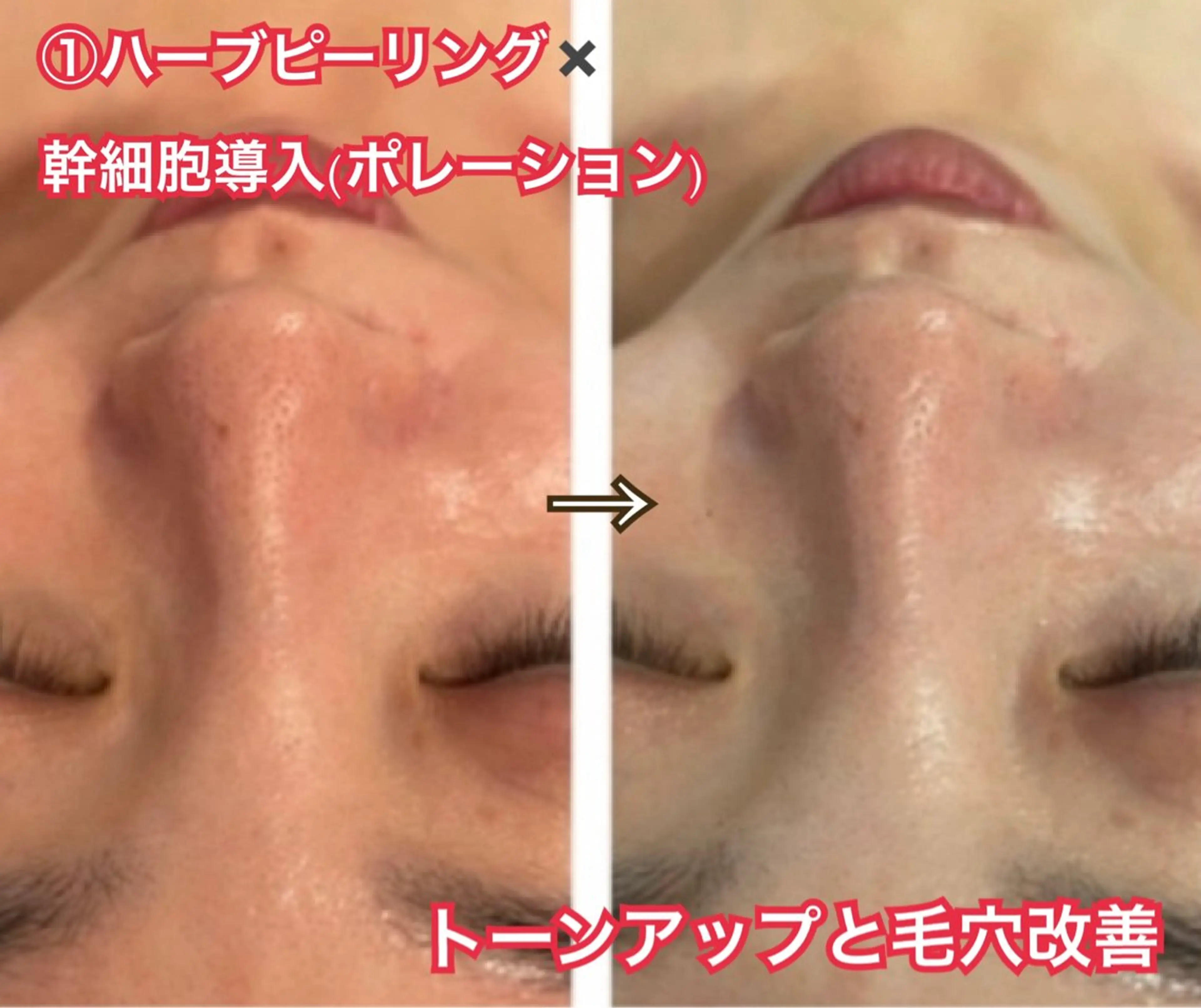 LAESSE 恵比寿所属・毛穴と美白の専門店 LAESSE 恵比寿のエステ・リラクイメージ