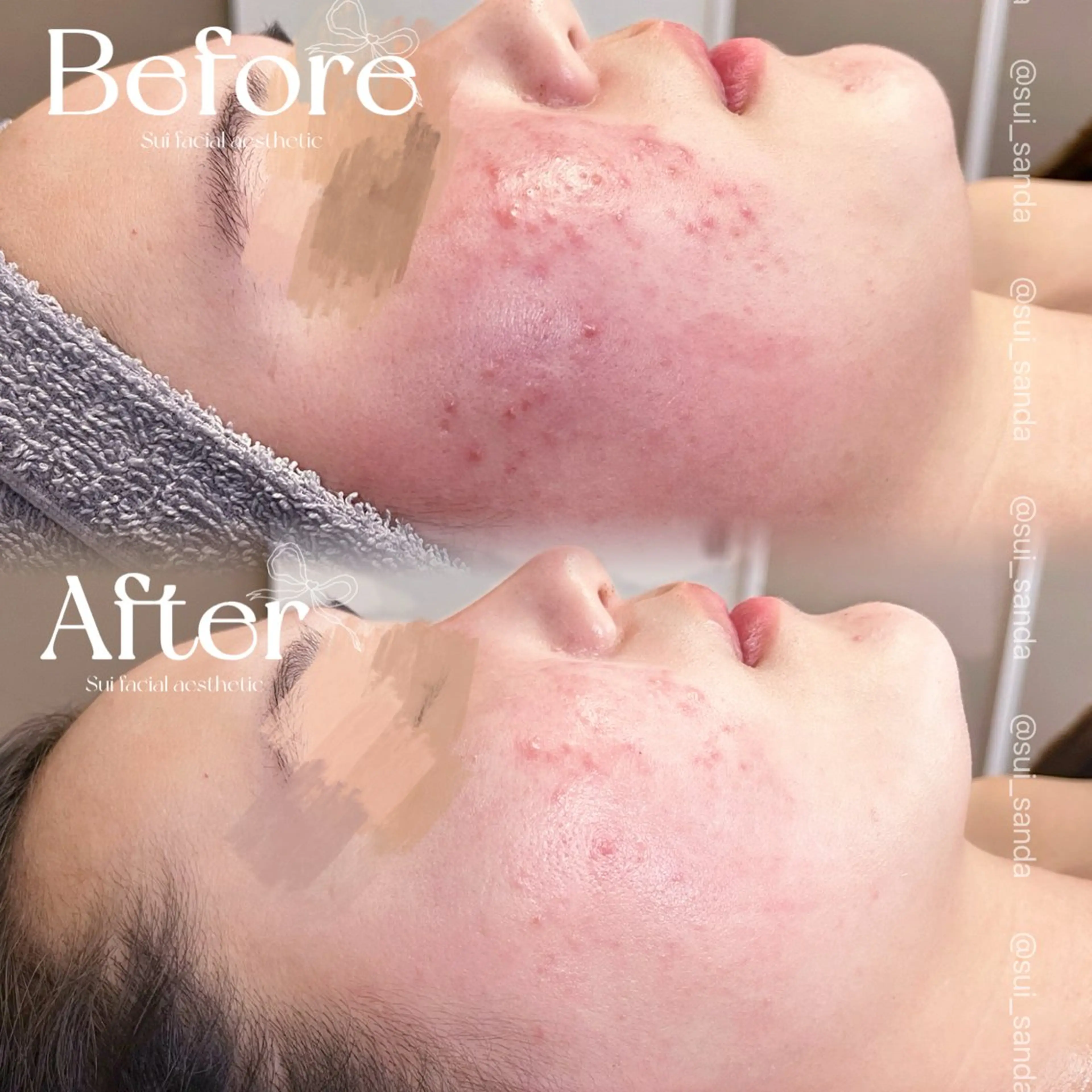 エステ Sui所属・Sui Eye & Beautyのマツエク・マツパデザイン