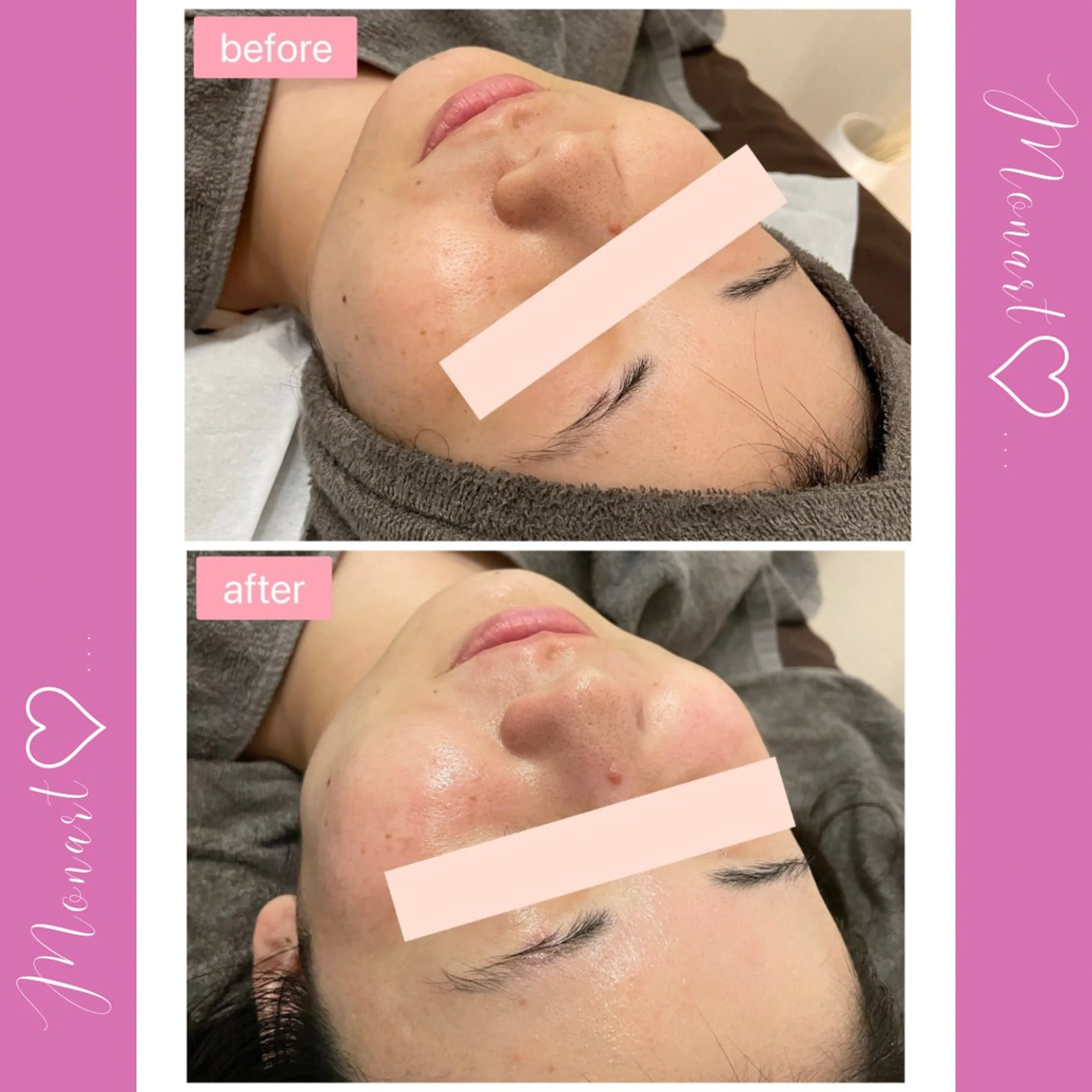 Monart -deux-のエステ・リラクイメージ