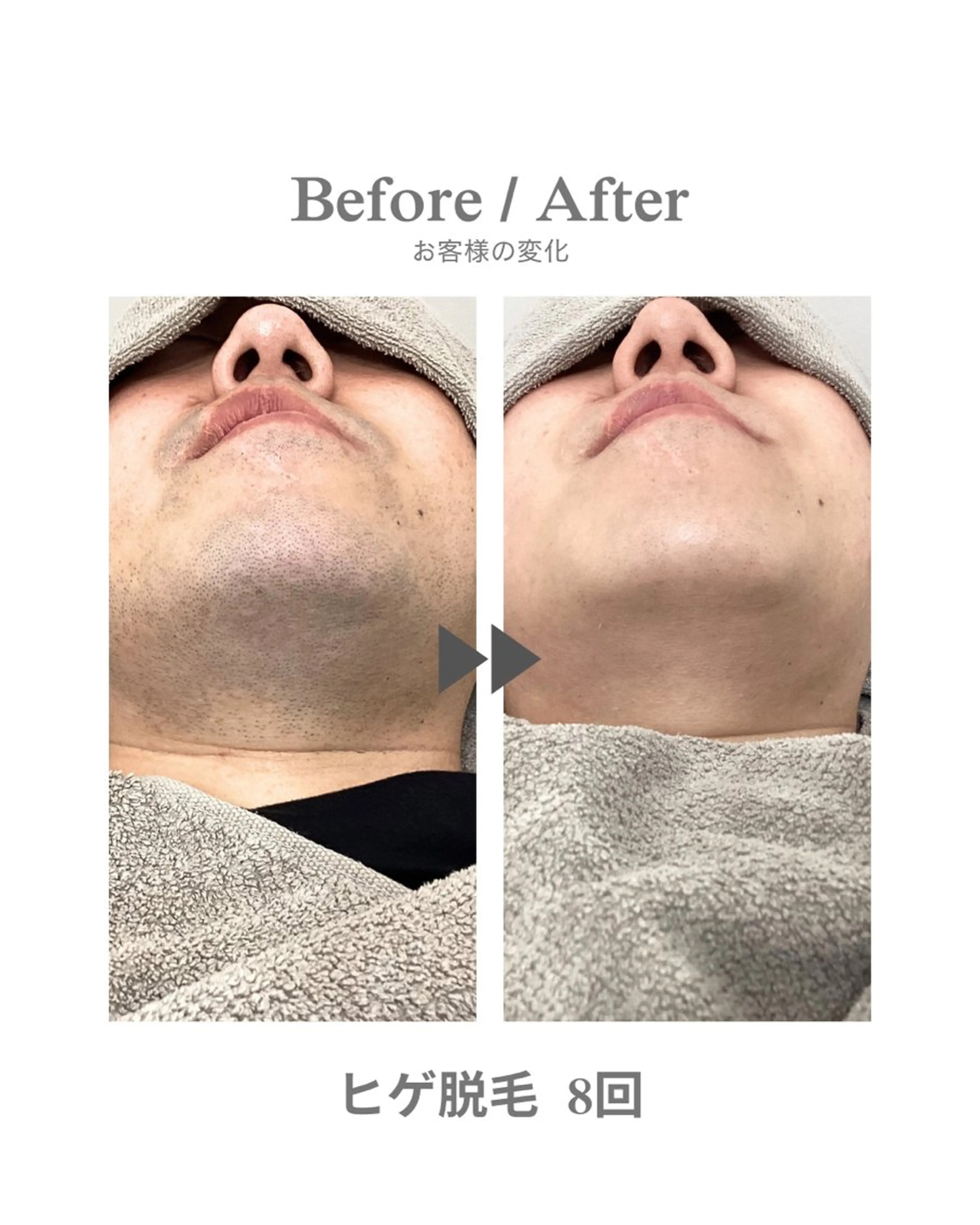 メンズ 脱毛 エステサロンNarcis〜ナルシス〜所属・脱毛＆痩身エステ Narcisのエステ・リラクイメージ