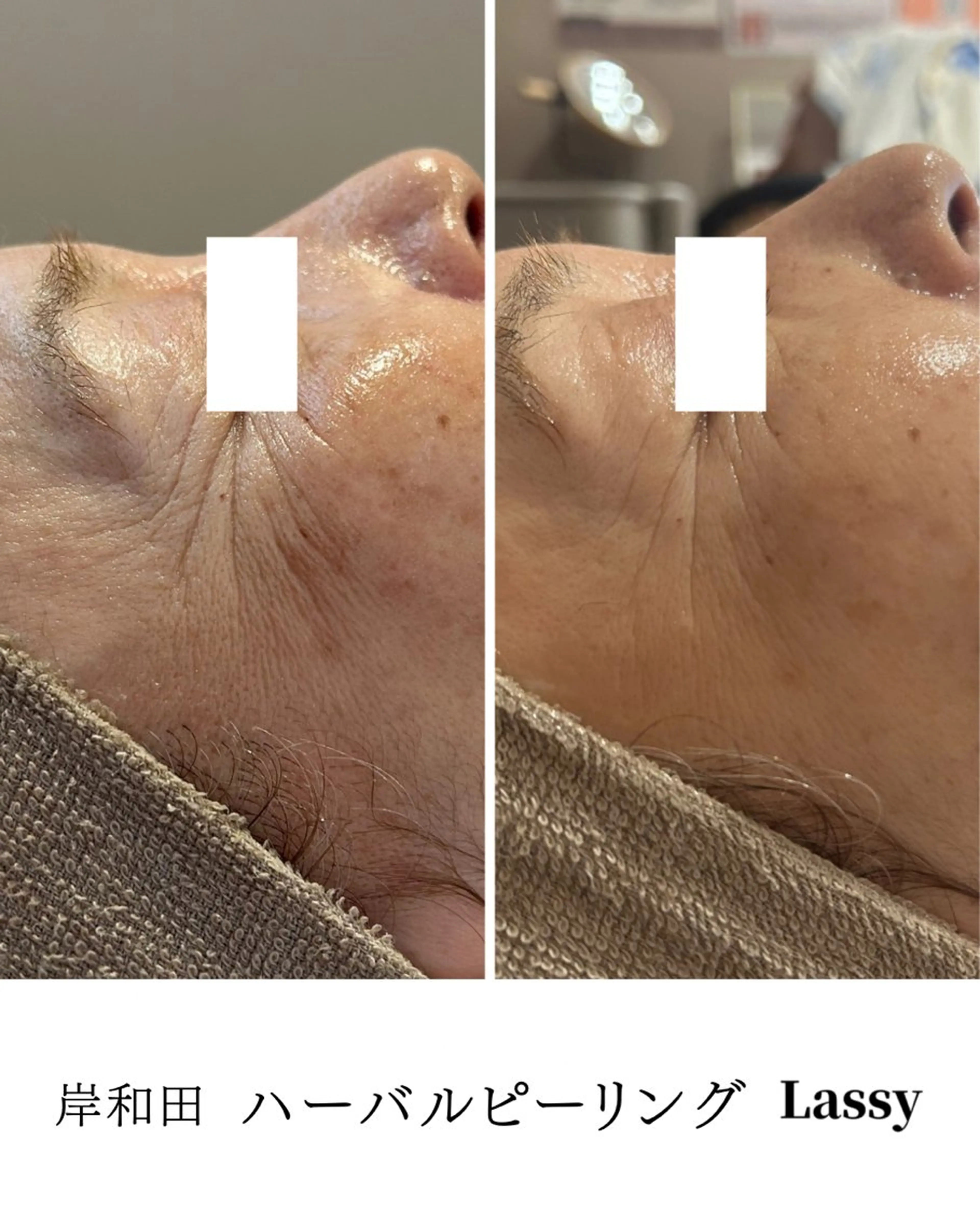 エステ Lassy keikoのその他イメージ