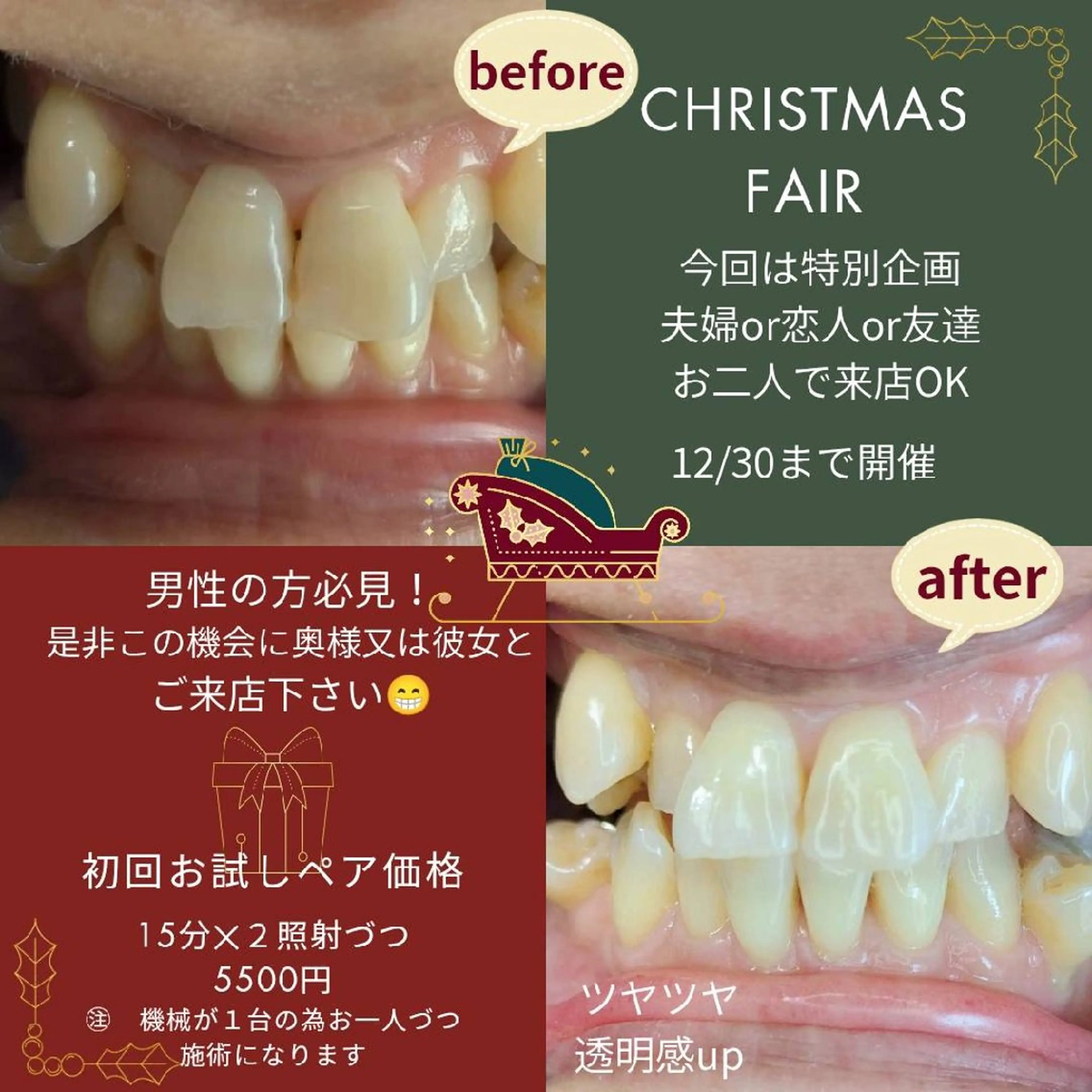 その他 ホワイトニングサロン keiのその他イメージ