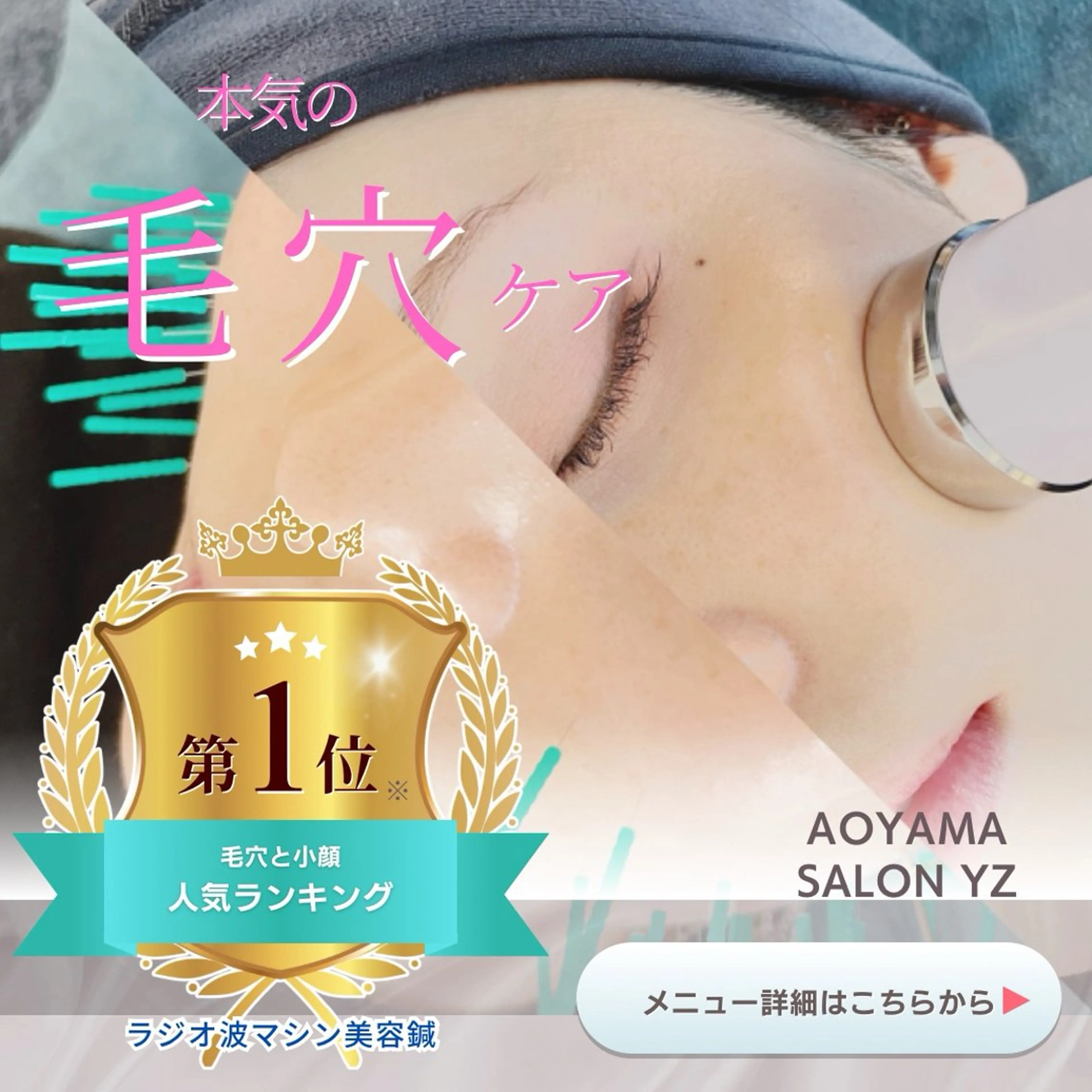 🔹RF(ラジオ)波+美容鍼🔹毛穴・小じわ・ほうれい線が気になる方におすすめ✨の写真