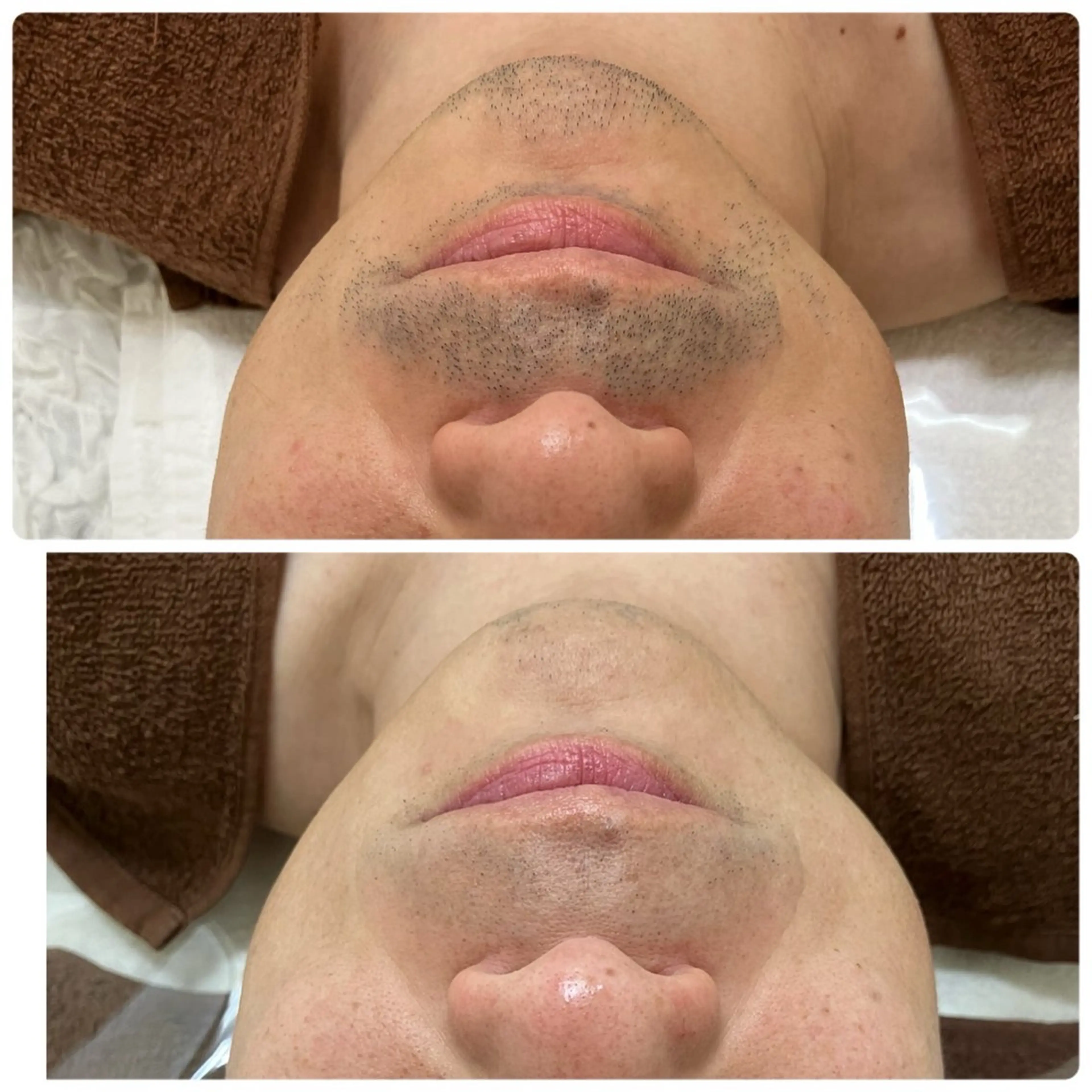 メンズ A/S アズのエステ・リラクイメージ