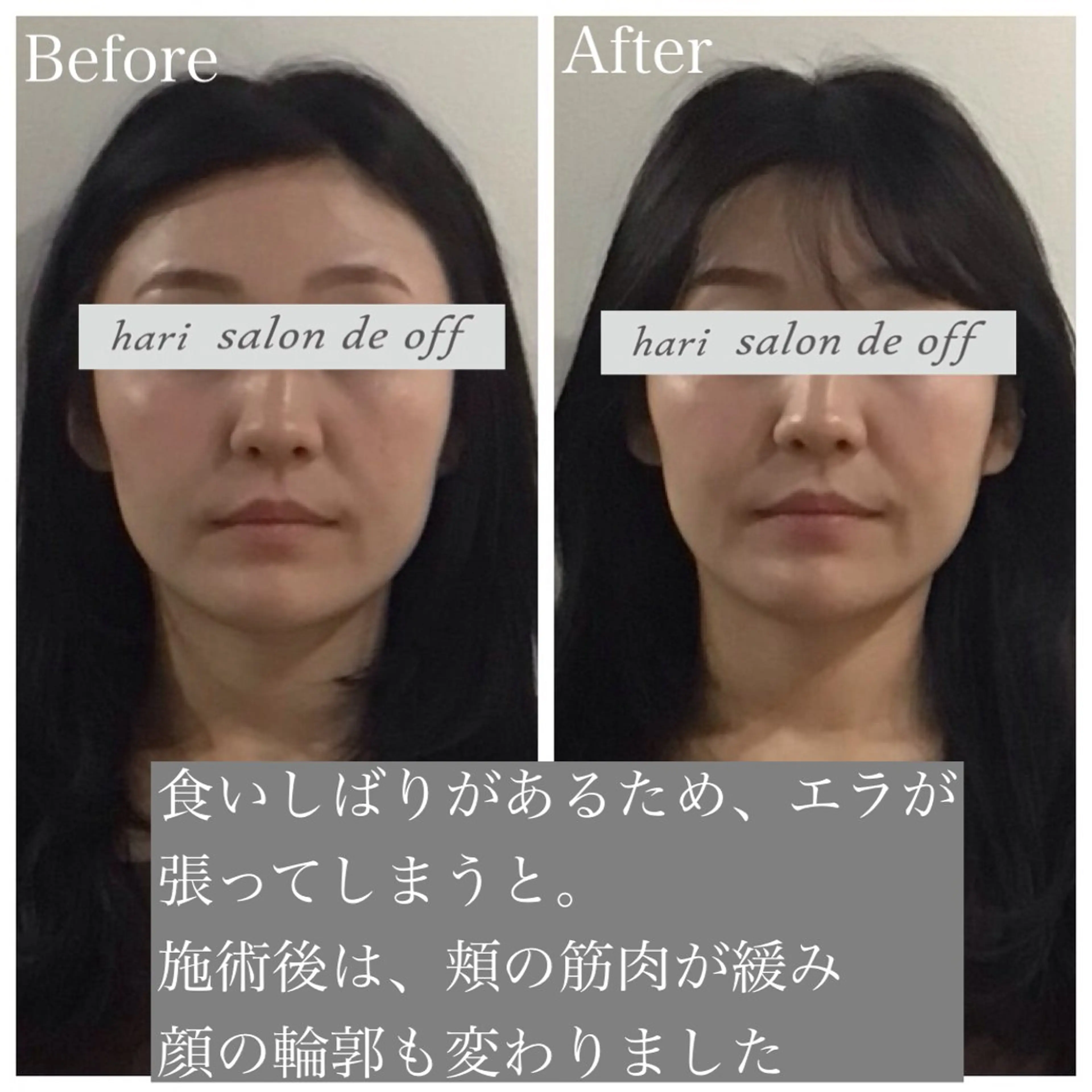 エステ リラク 整体×美容鍼灸 鍼灸師Miyanoのエステ・リラクイメージ