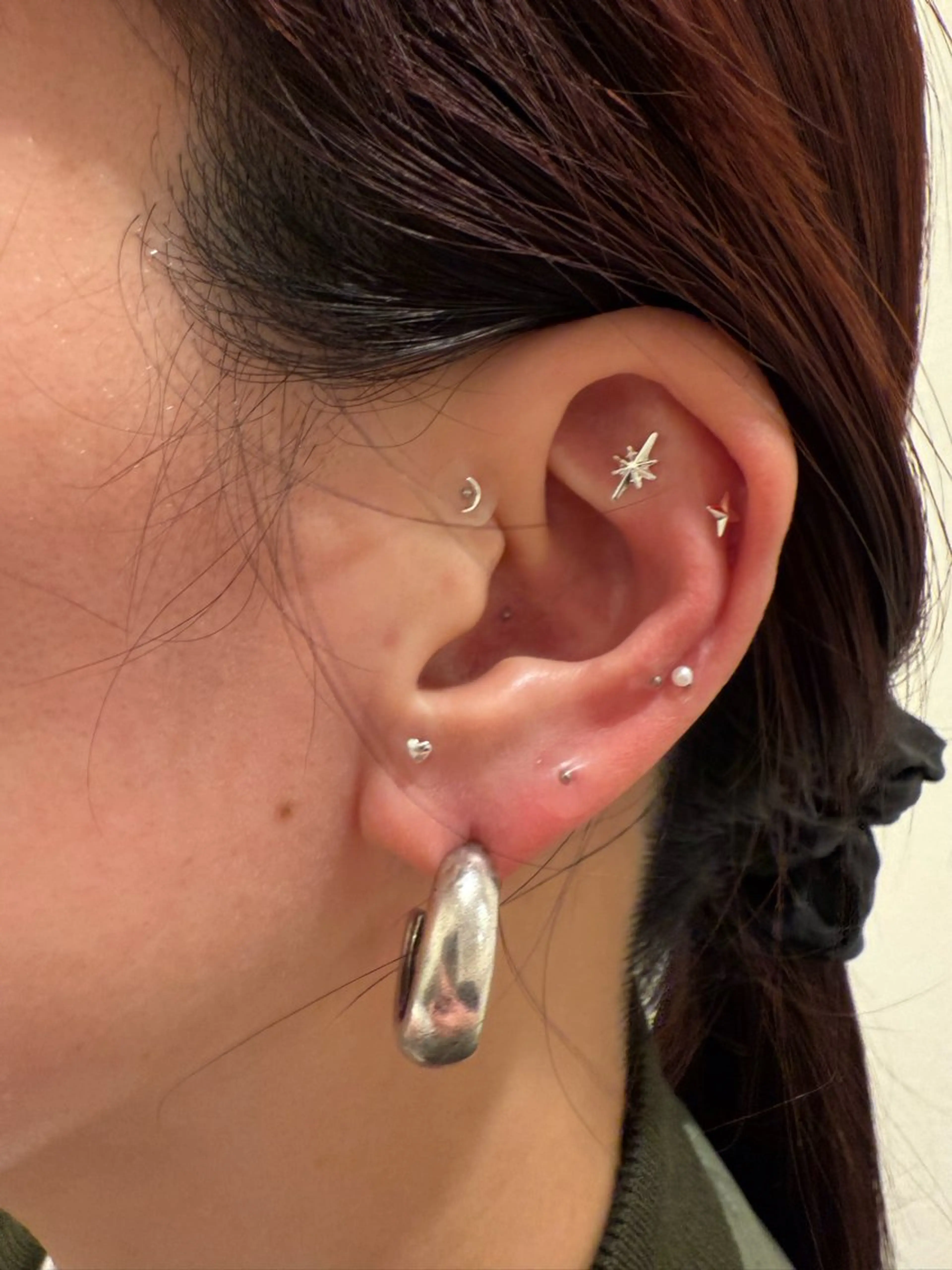 ADDICT中目黒店所属・毛穴洗浄/毛穴ケア 🌿中目黒🌿のエステ・リラクイメージ