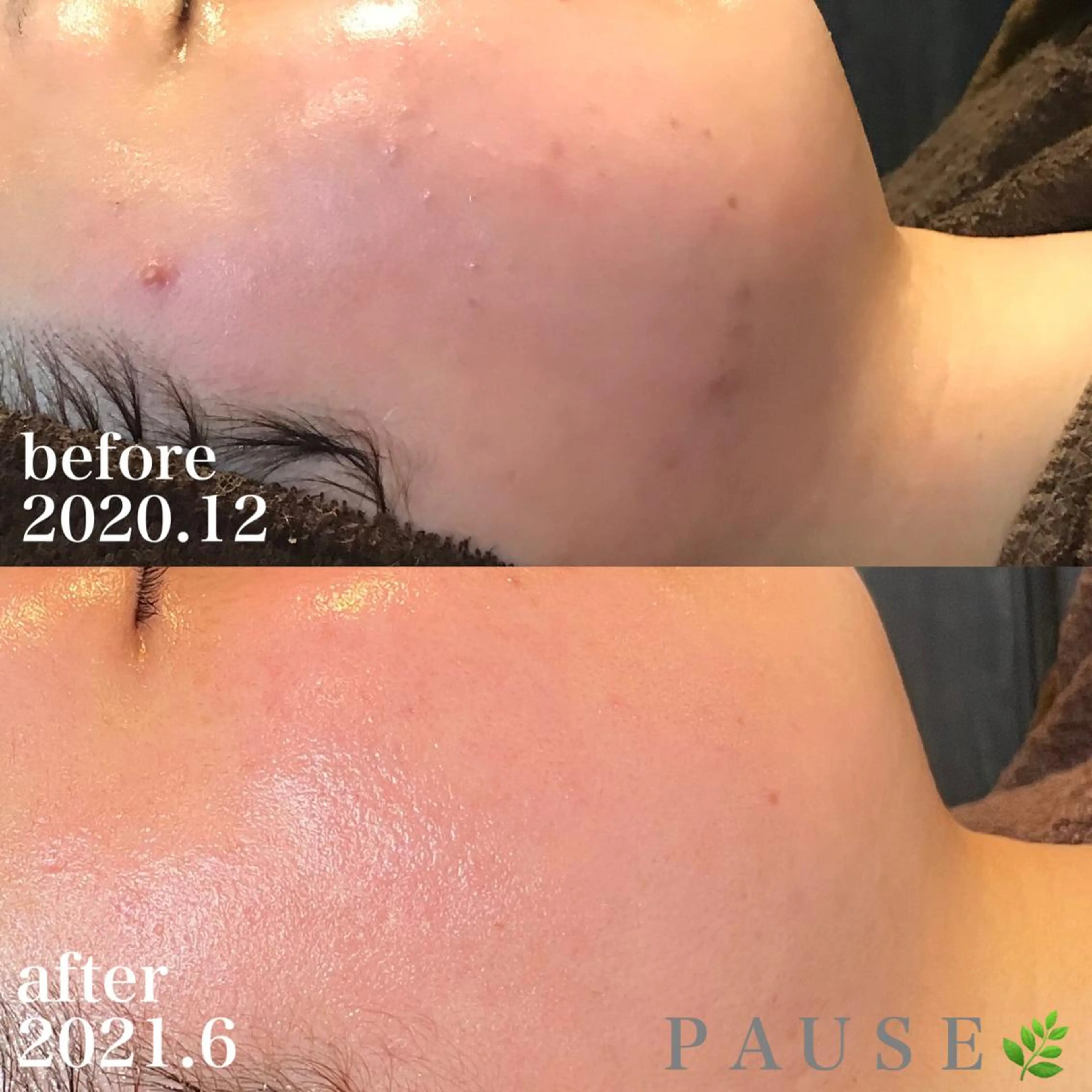 エステ 浜野 恵美のエステ・リラクイメージ