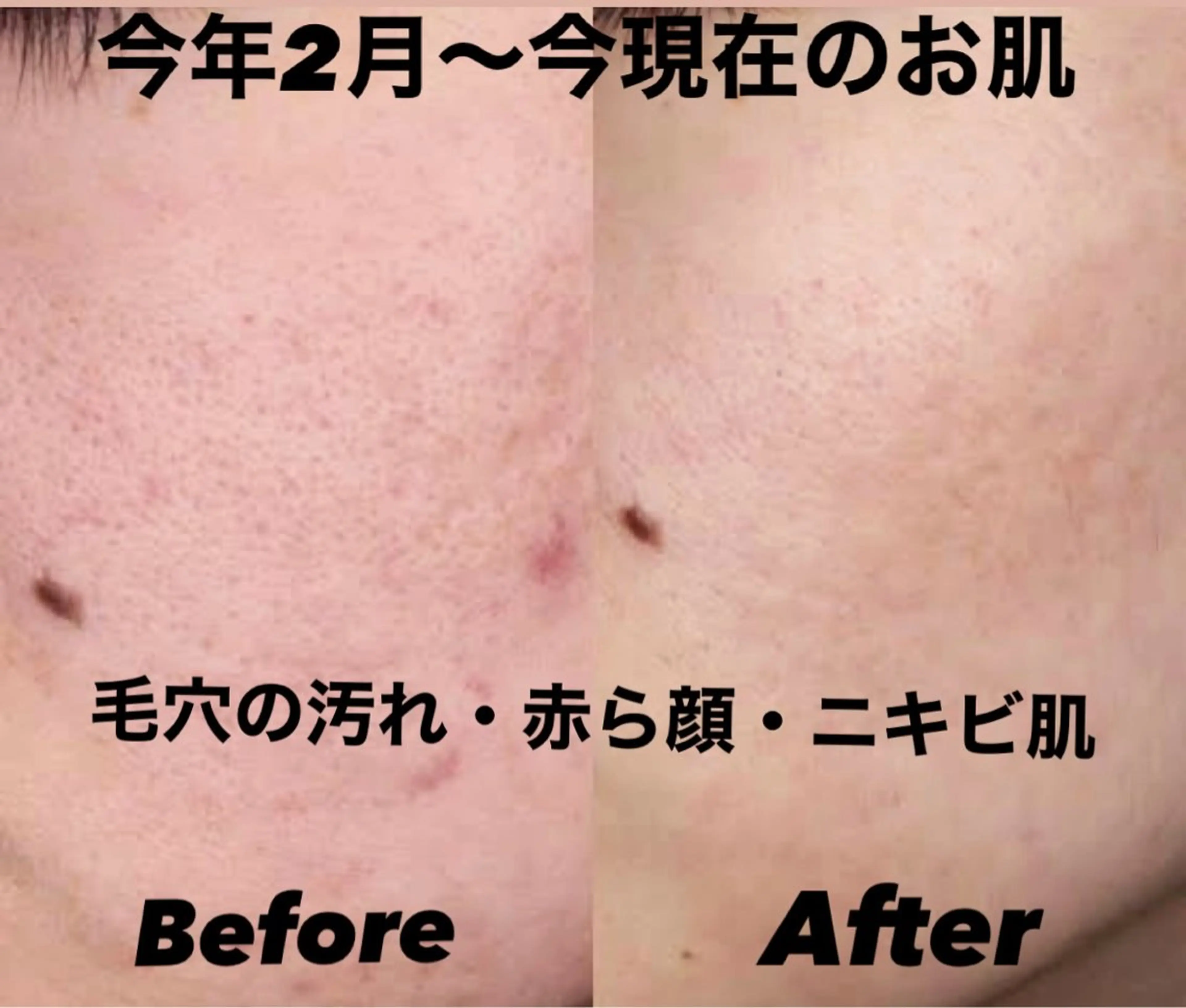 IRISE エステのエステ・リラクイメージ