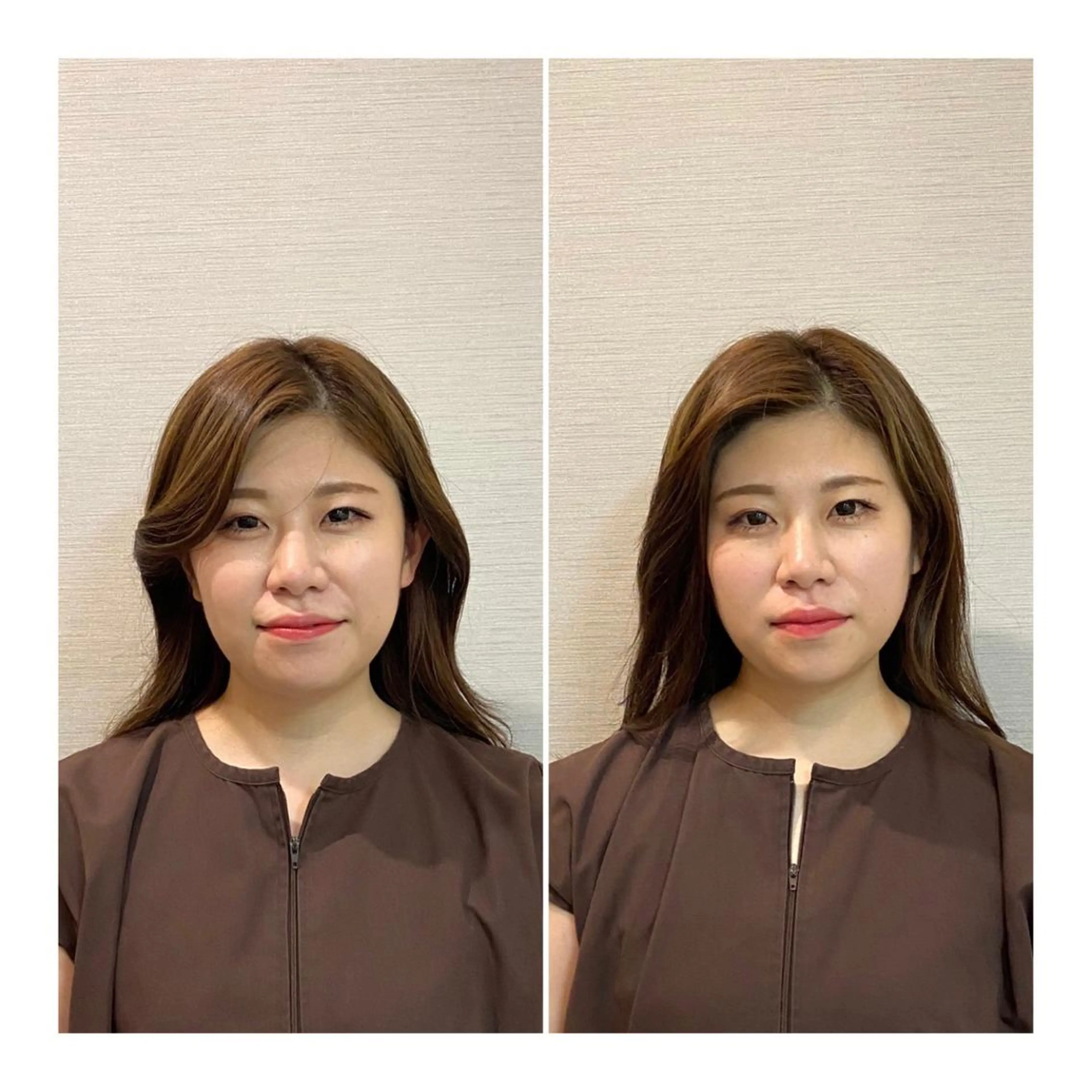 ロング 即小顔♥️美容鍼× ハーブピーリングのその他イメージ