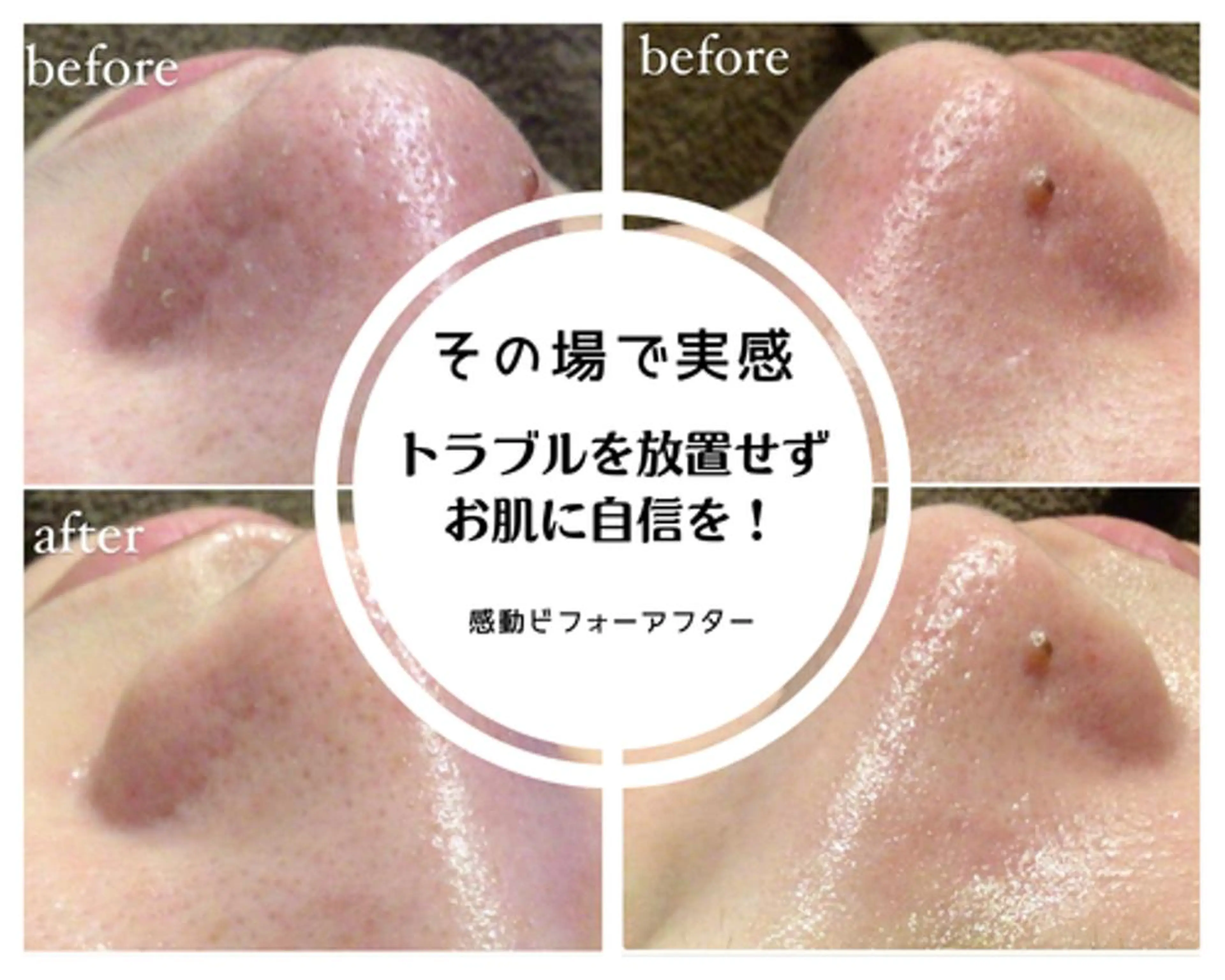 毛穴専門店Bébé 大阪中央店のエステ・リラクイメージ