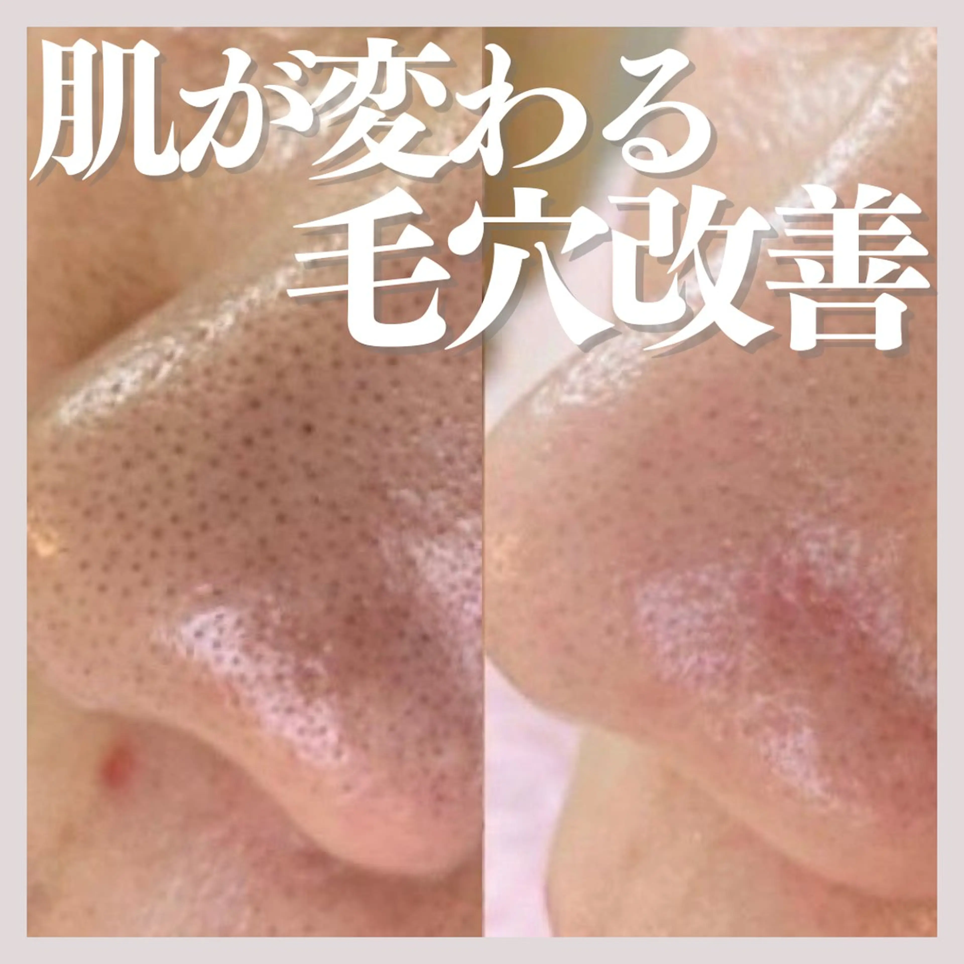 エステ salon MUSUBUのエステ・リラクイメージ