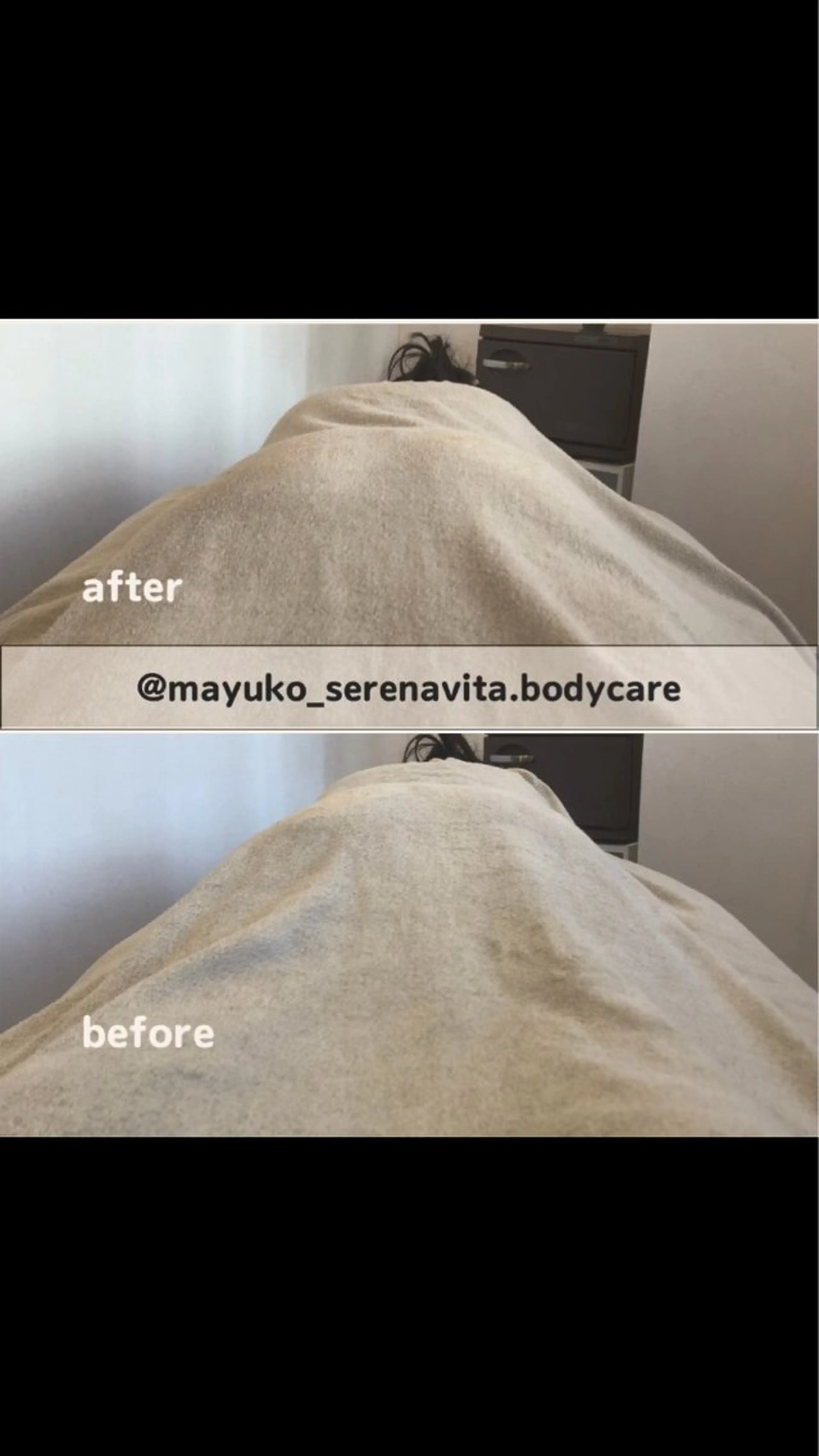 ゆるやかな曲線しっとりヒップへ《ビューティフルヒップ体験モニター様募集中!before→after写真撮影可能な方》の写真