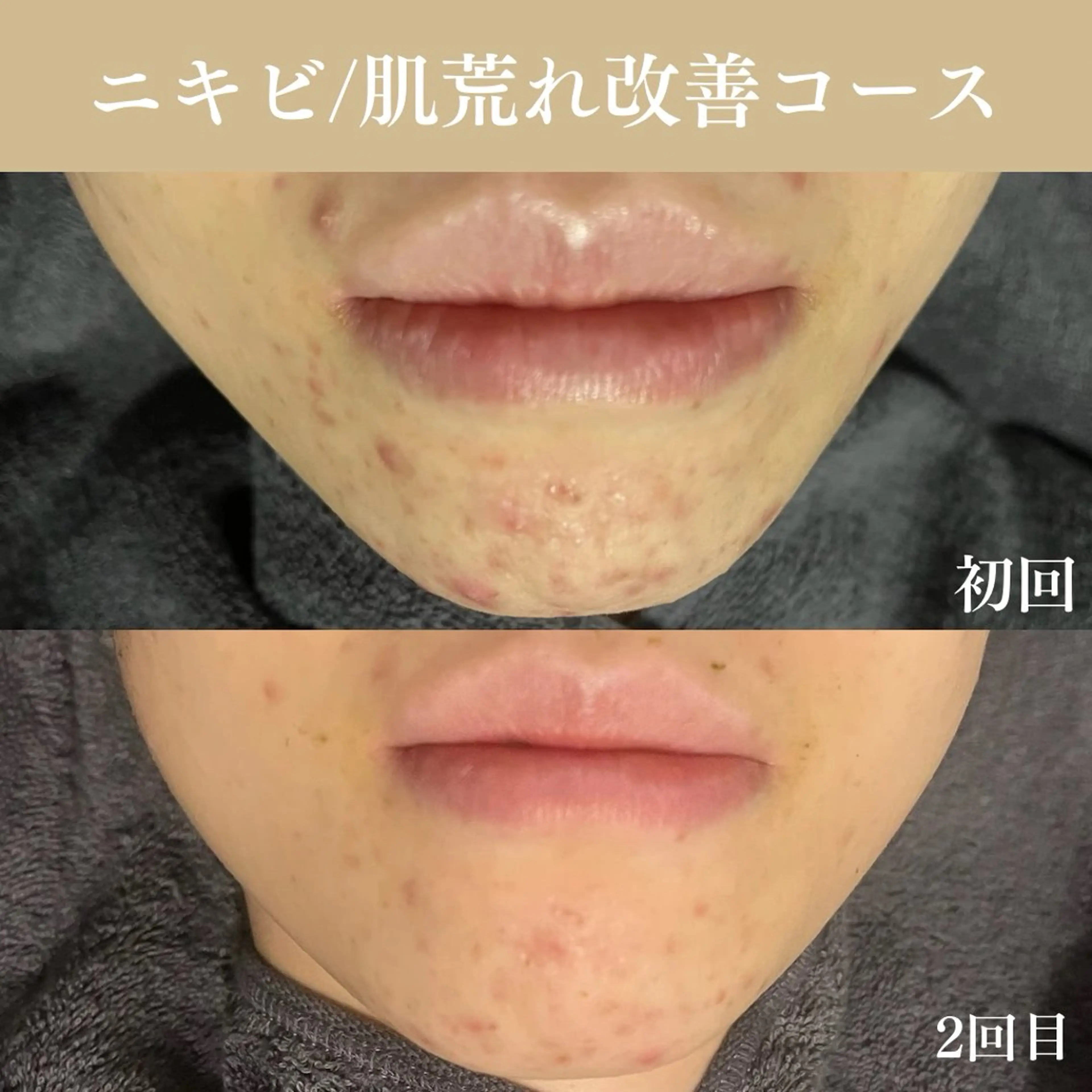 Oncebell. Bodymake&beautysalon所属・Oncebell. ワンベルのエステ・リラクイメージ