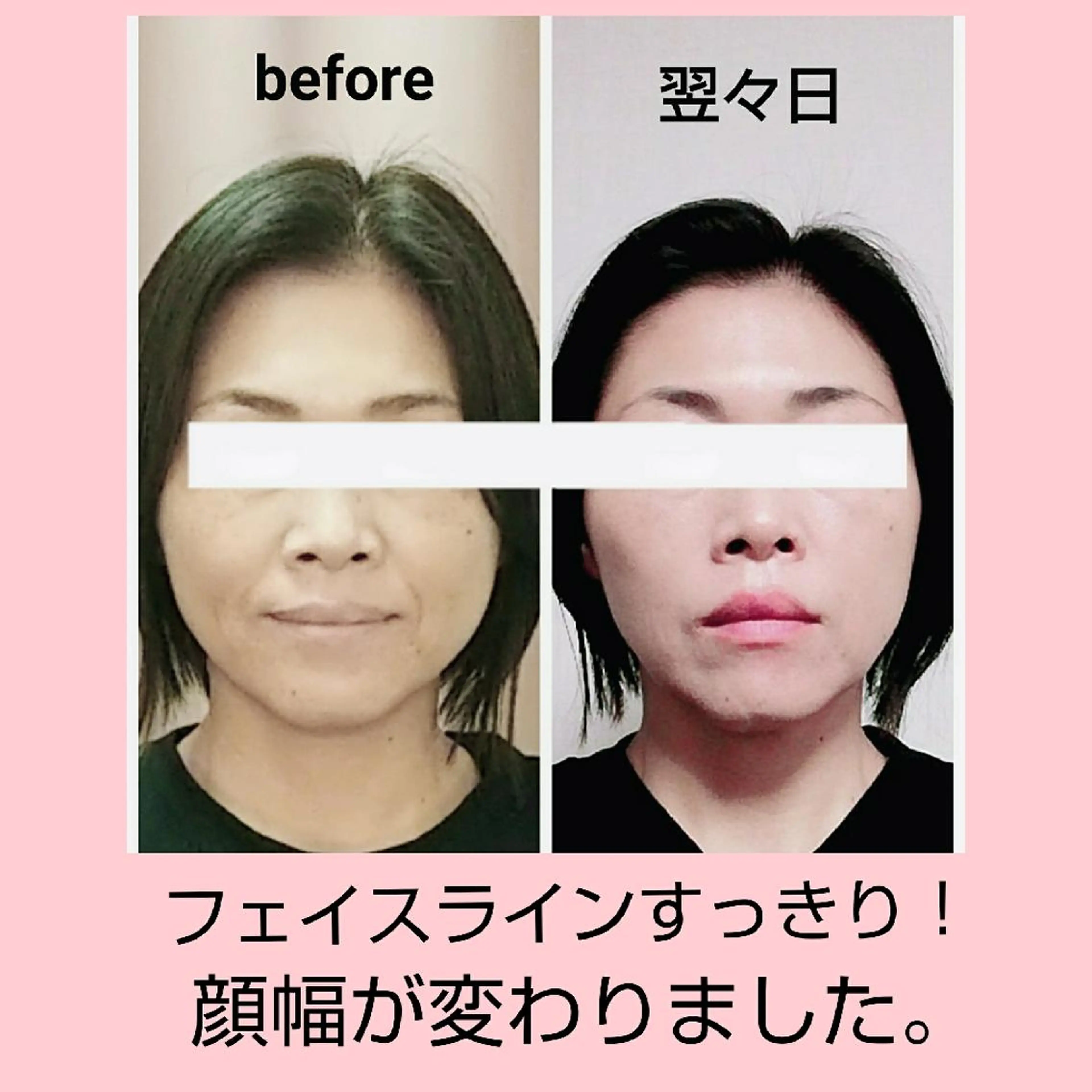 小顔と美肌 まごころエステMatoria所属・小顔 美肌専門 Matoriaのエステ・リラクイメージ