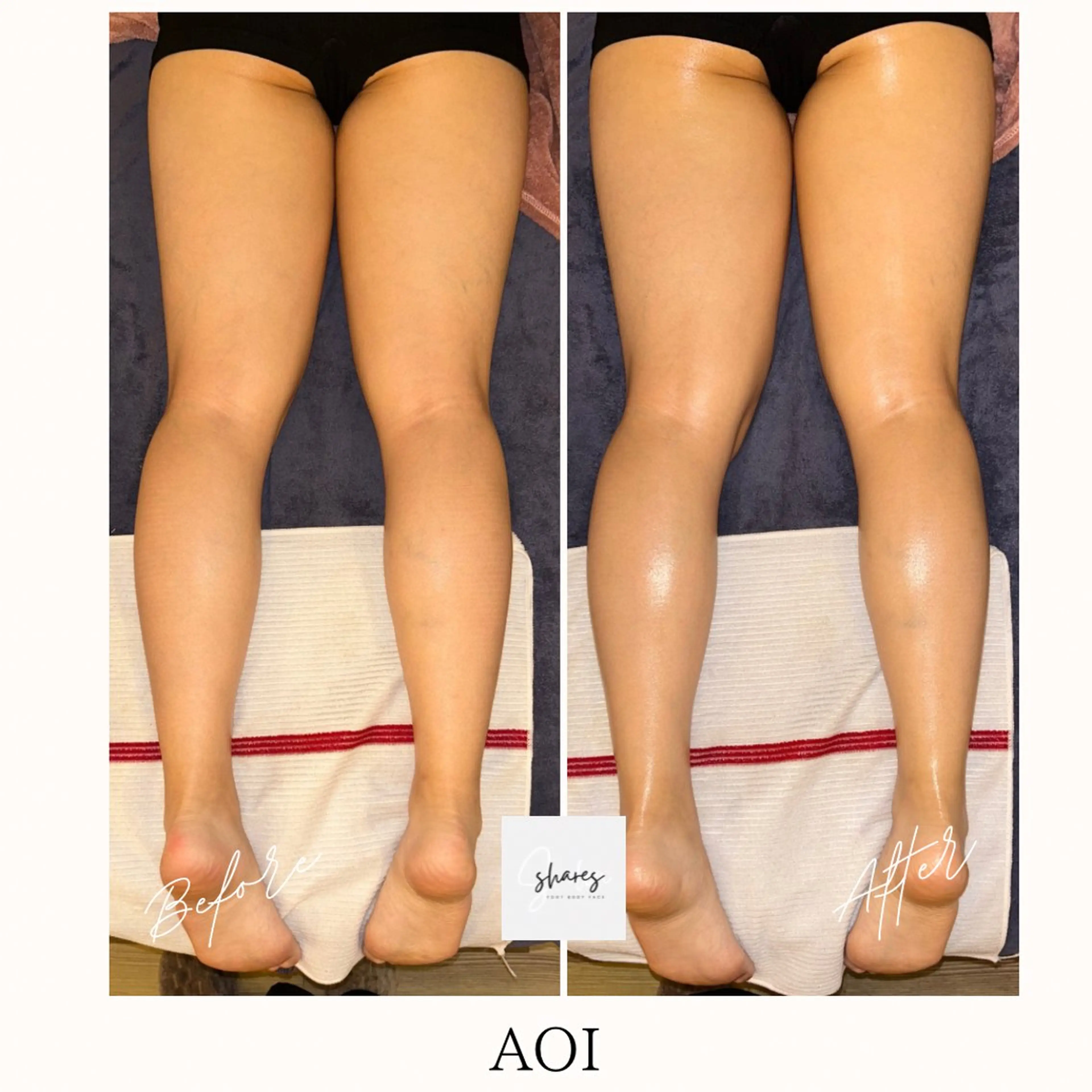 salon shares 辻堂店所属・SHARES AOIのエステ・リラクイメージ