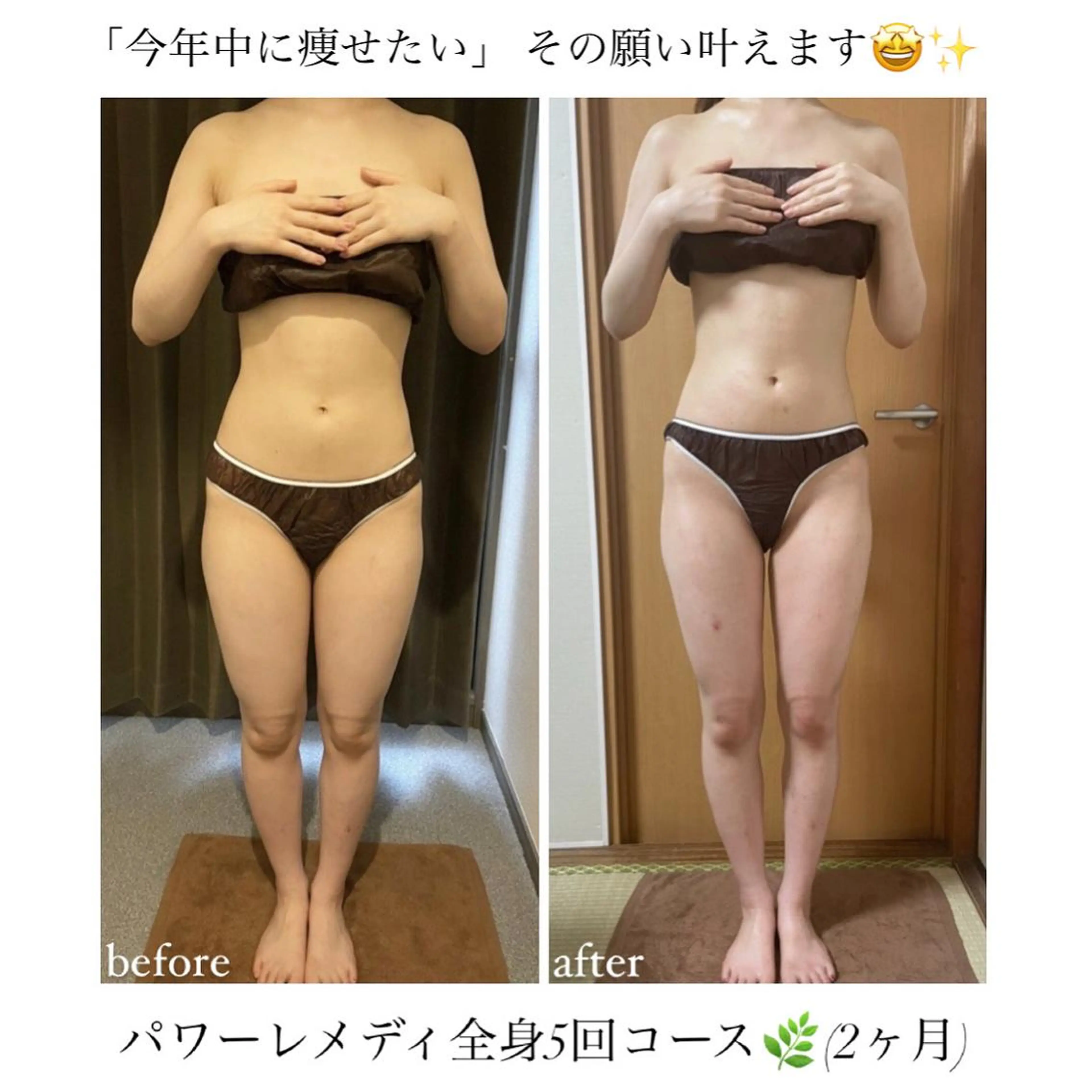 biloop所属・《本気痩せ×疲労改善 》  BILOOPのエステ・リラクイメージ