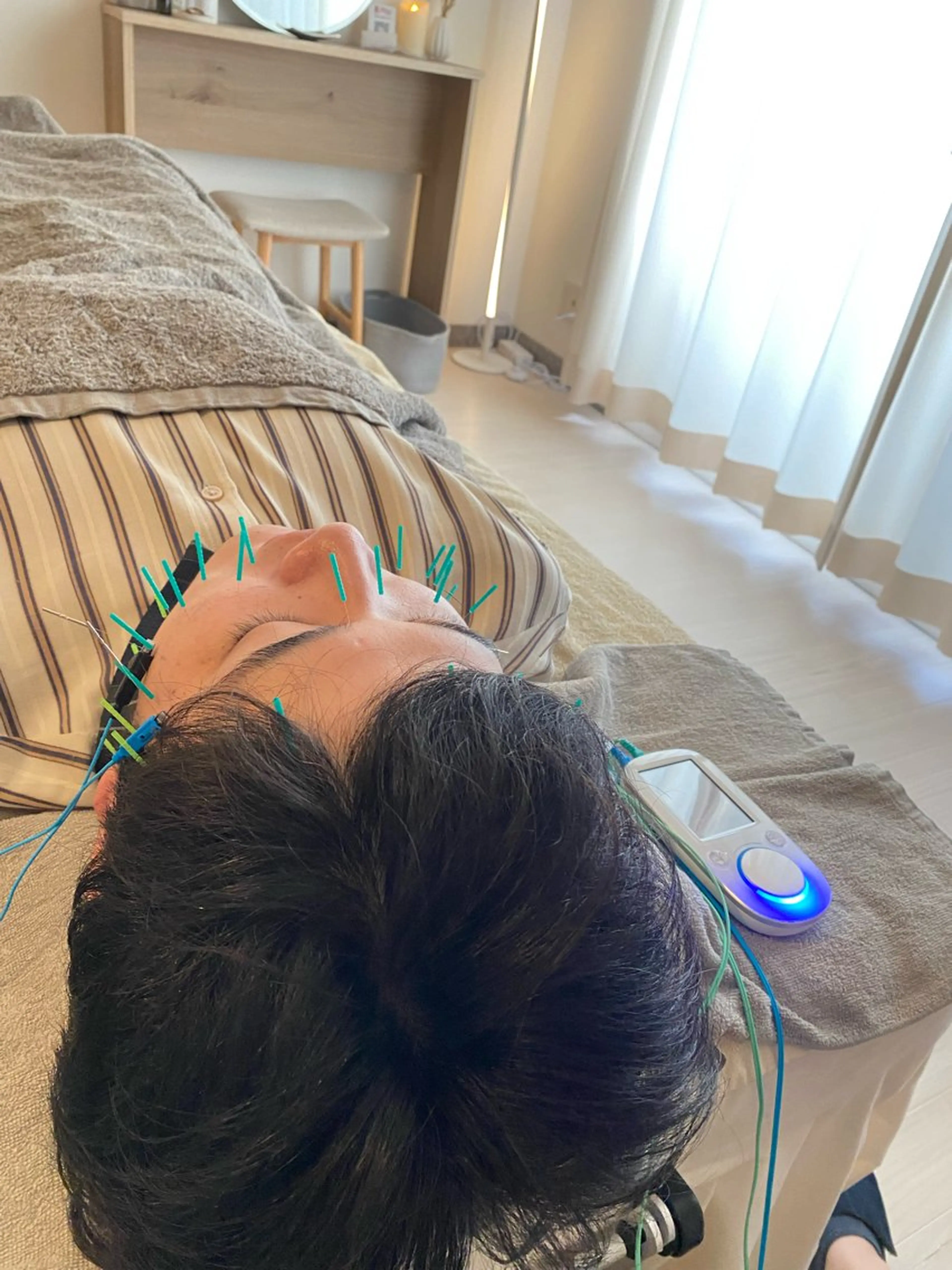 エステ リラク 鍼灸•マッサージサロンCalfa所属・《美肌･小顔》美容鍼 ＆マッサージ＊MEIのエステ・リラクイメージ