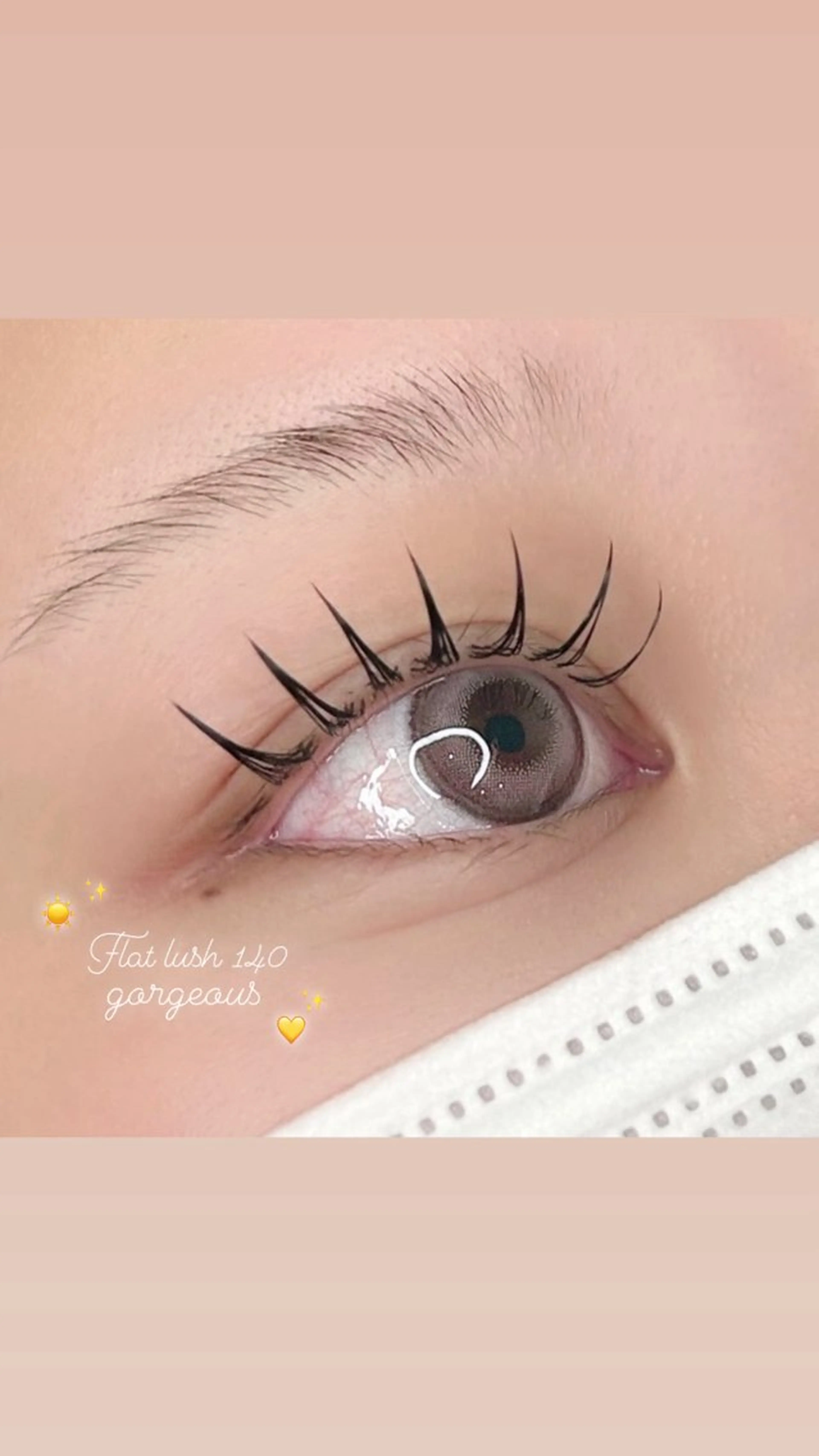 フラットラッシュ140本の写真