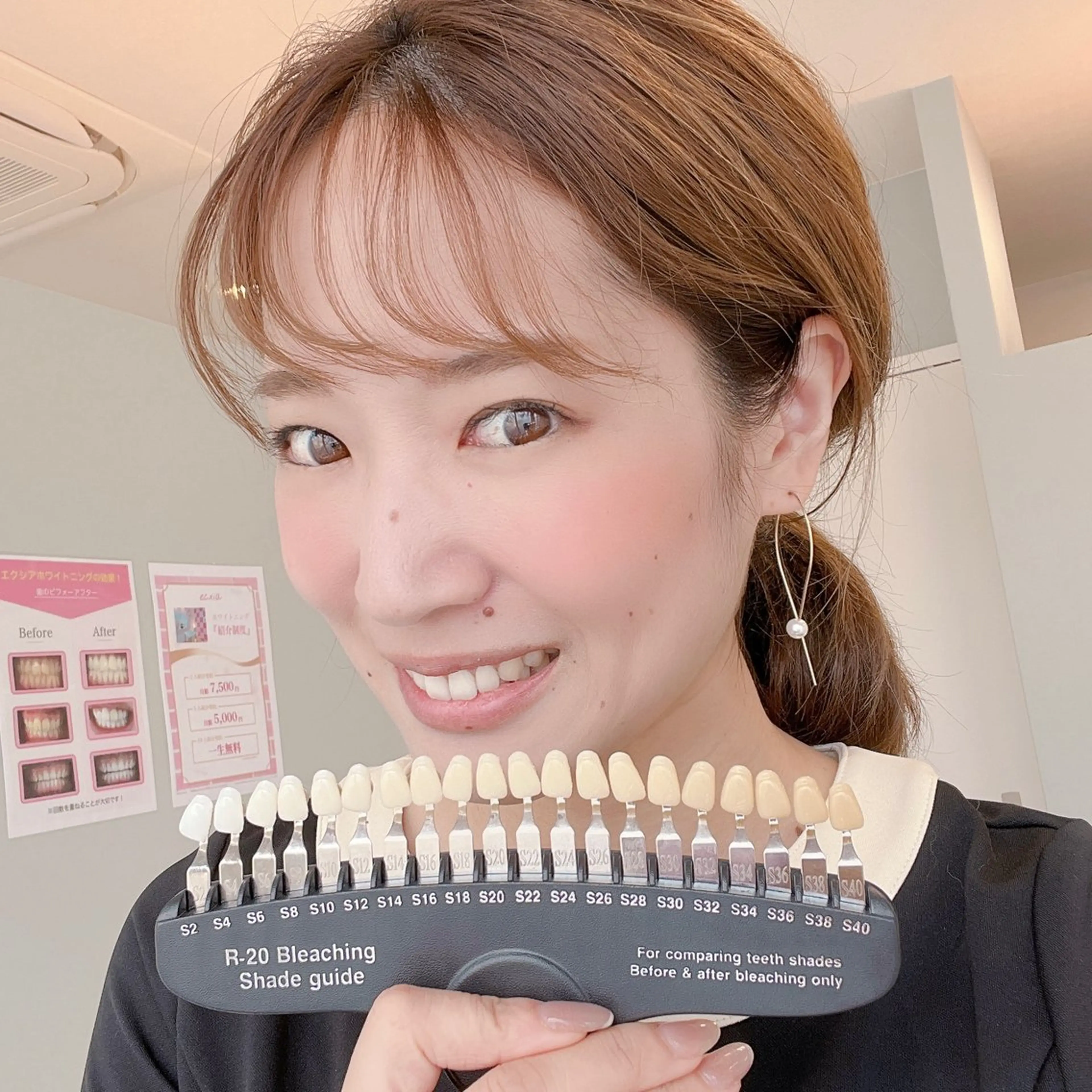 その他 エクシアホワイトニング草津店所属・nanami -ホワイトニングのその他イメージ