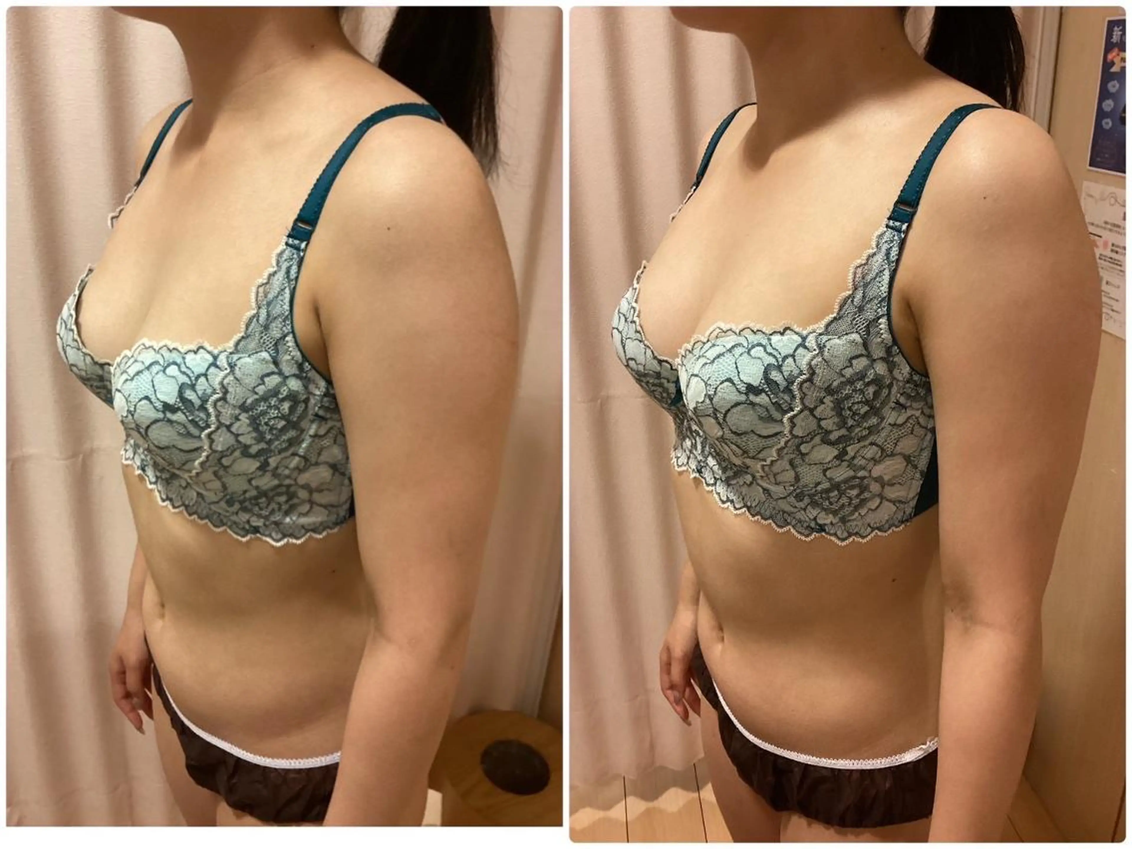 エステ リラク バスト専門店 RAYVIS🌺のエステ・リラクイメージ