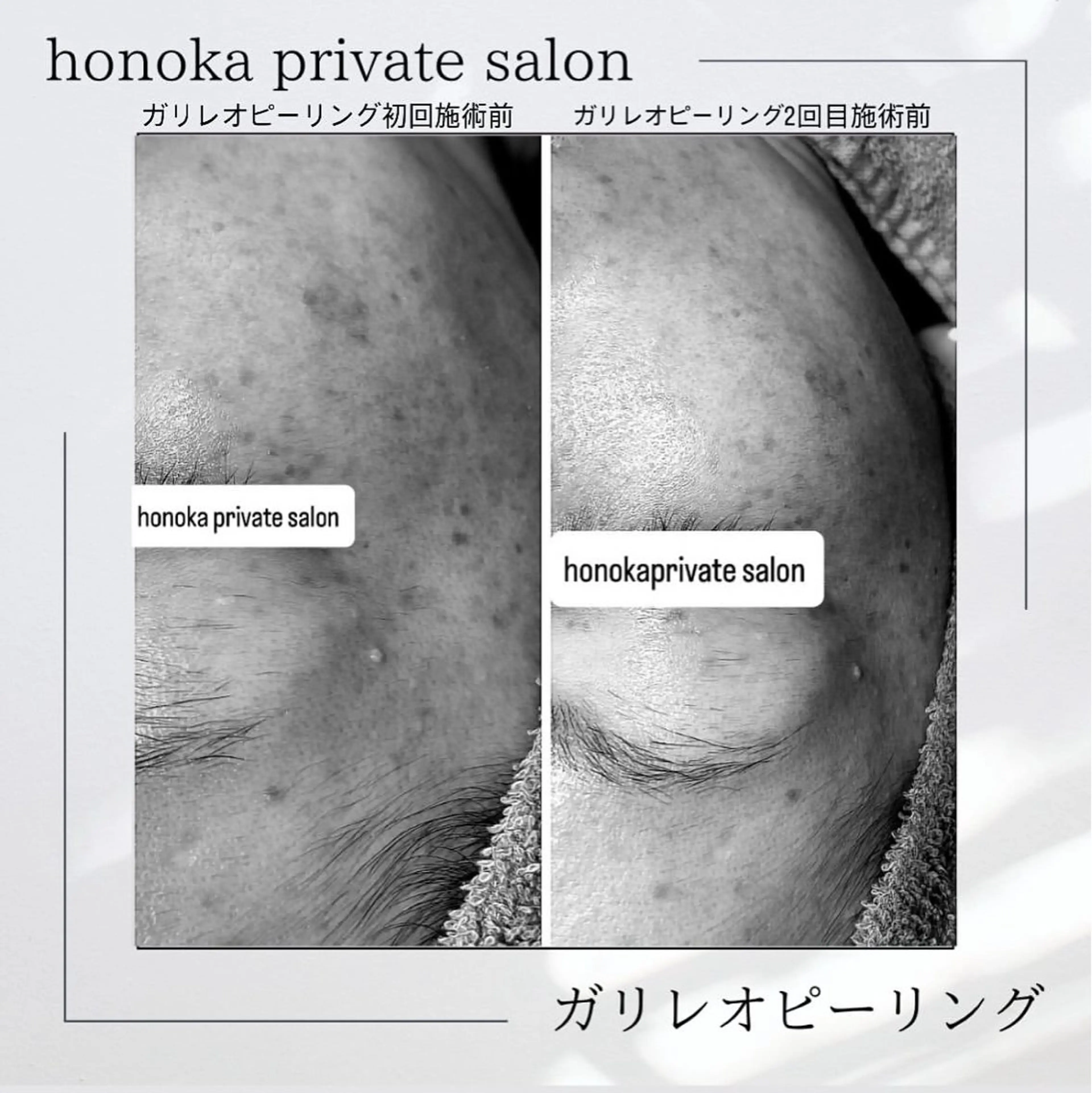 知念 美由紀のエステ・リラクイメージ