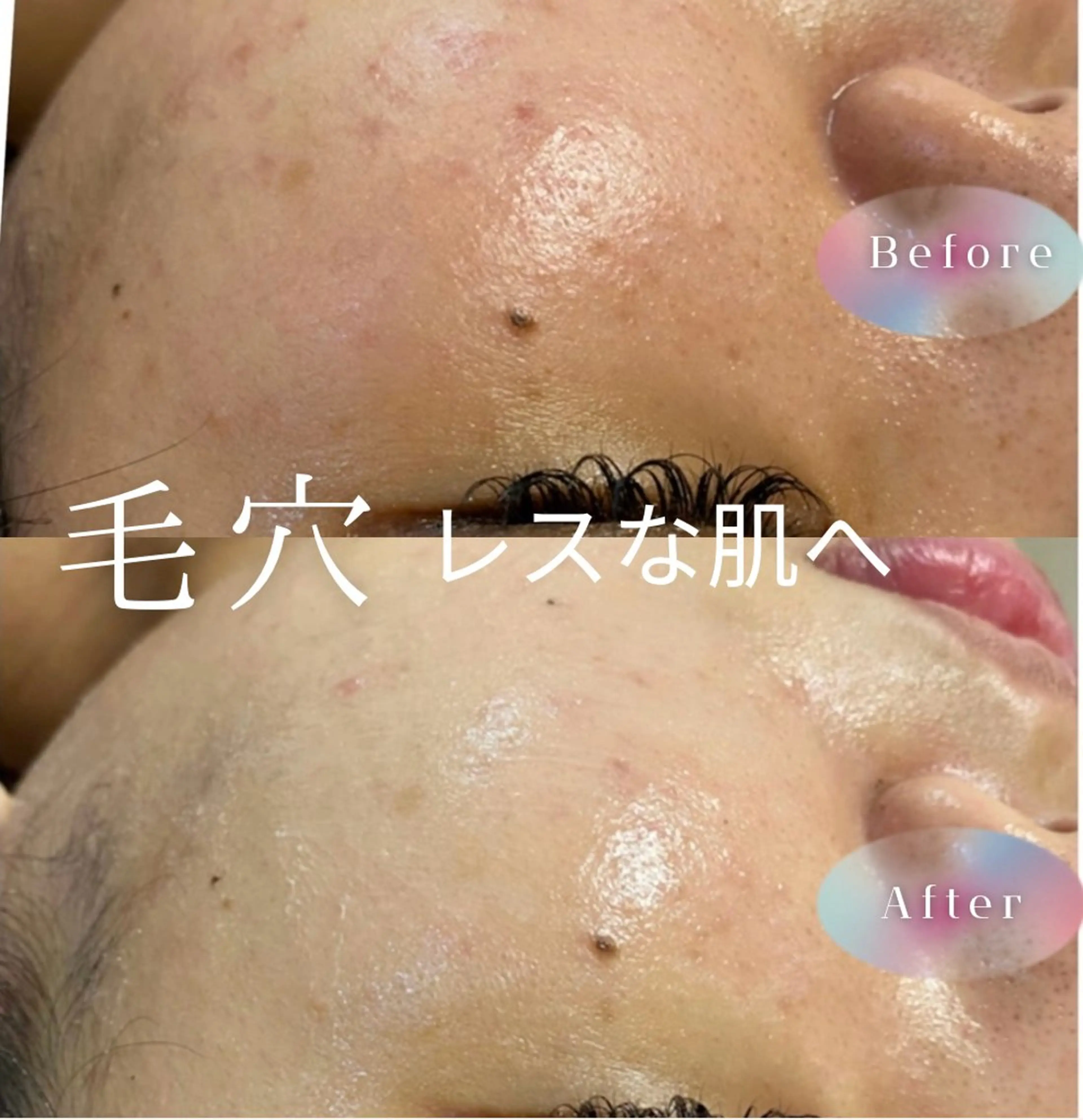 毛穴艶肌コースの写真