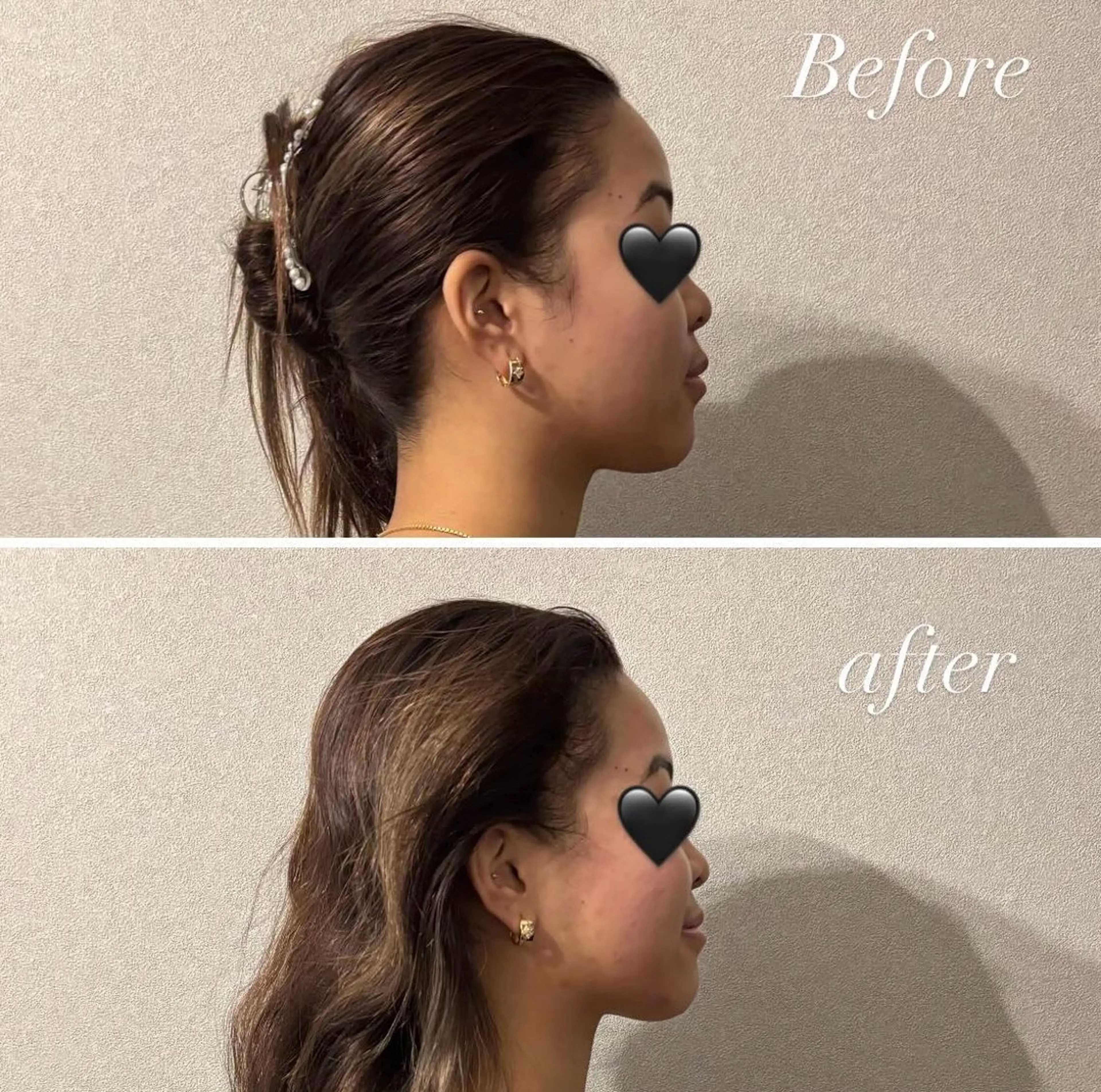 歴14年！劇的 小顔矯正Luanaのエステ・リラクイメージ