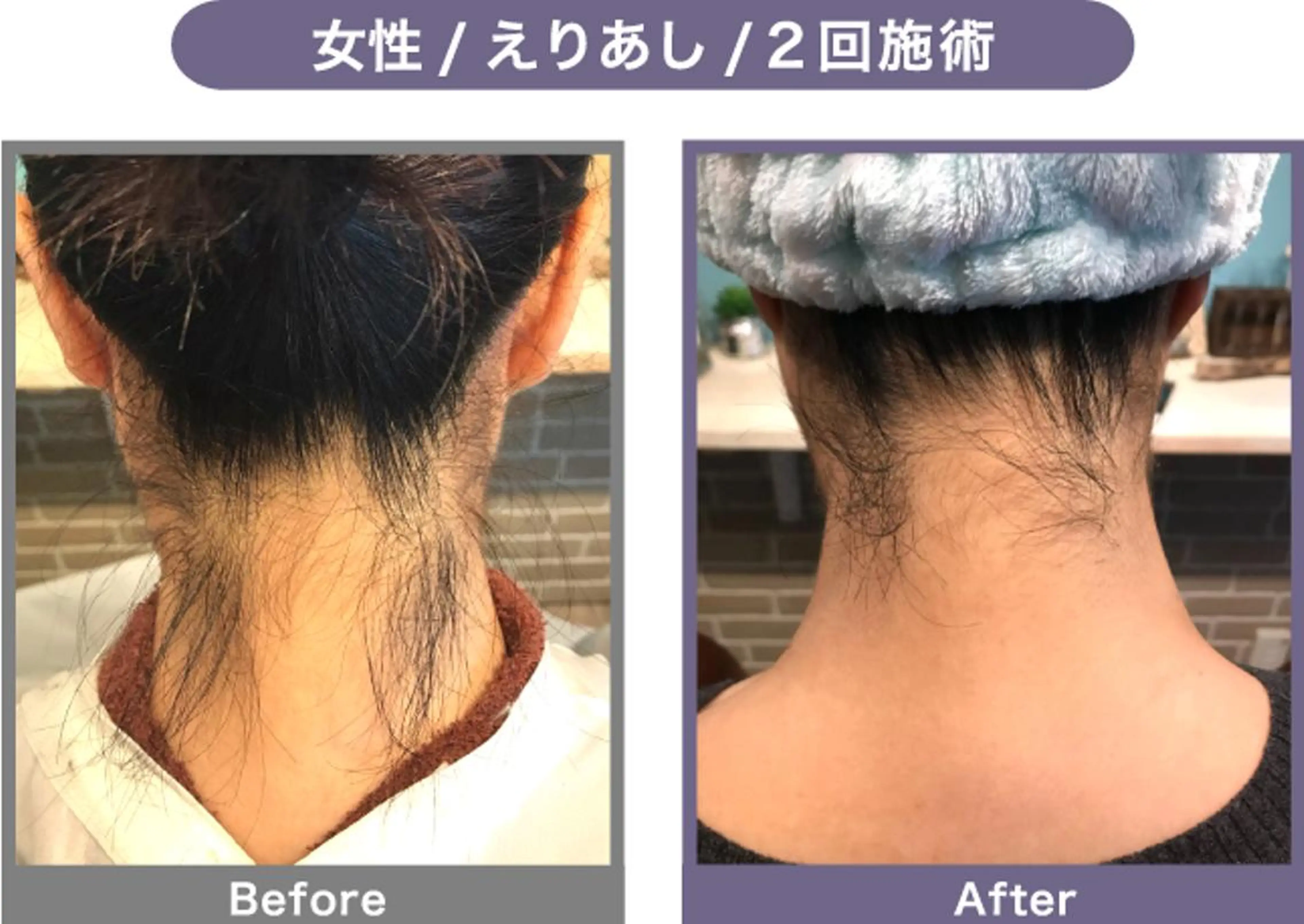 NONOKEKE ノノケケのエステ・リラクイメージ