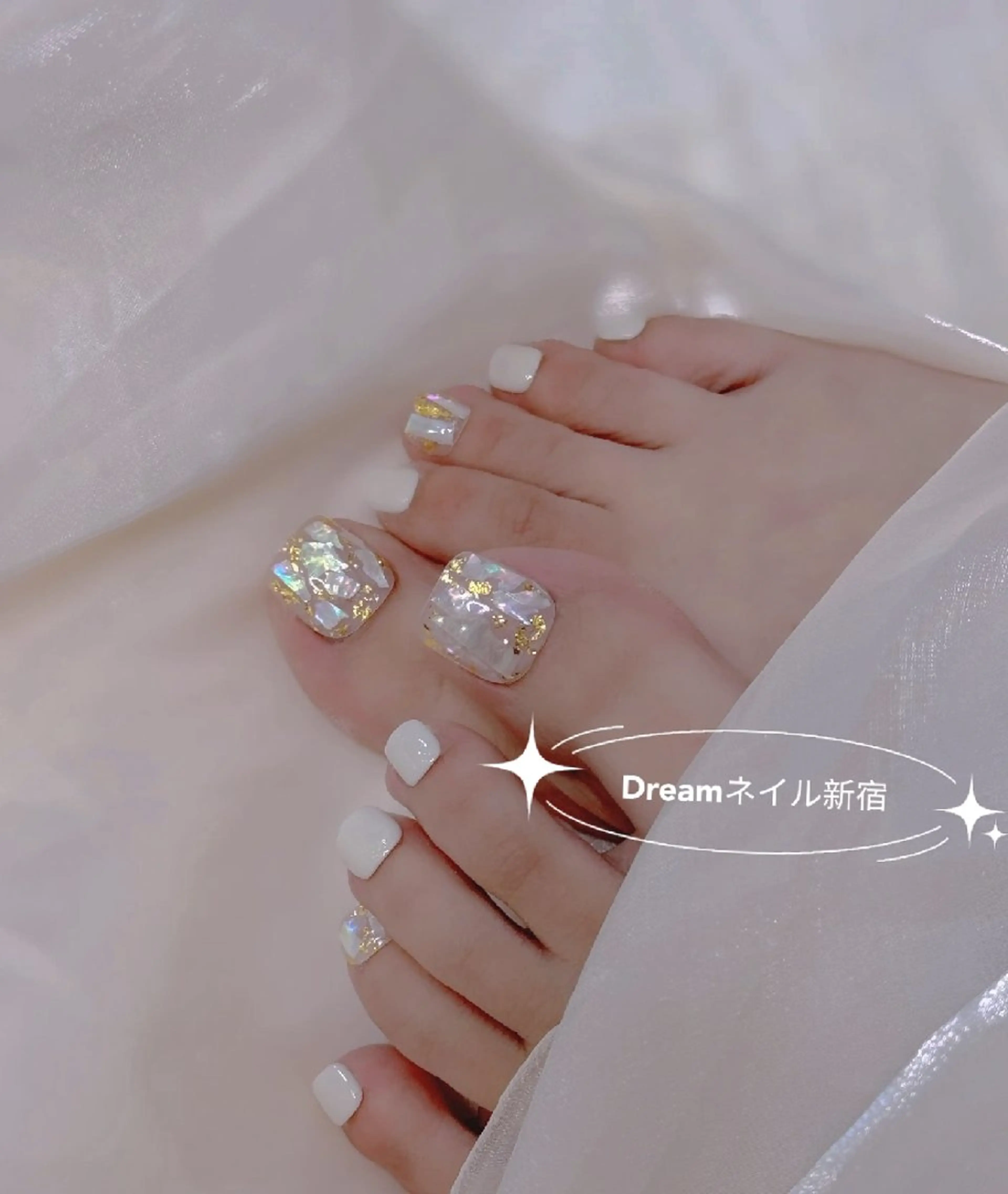 ネイル フットネイル ネイリストゆか💅 長さだし、深爪矯正のネイルデザイン