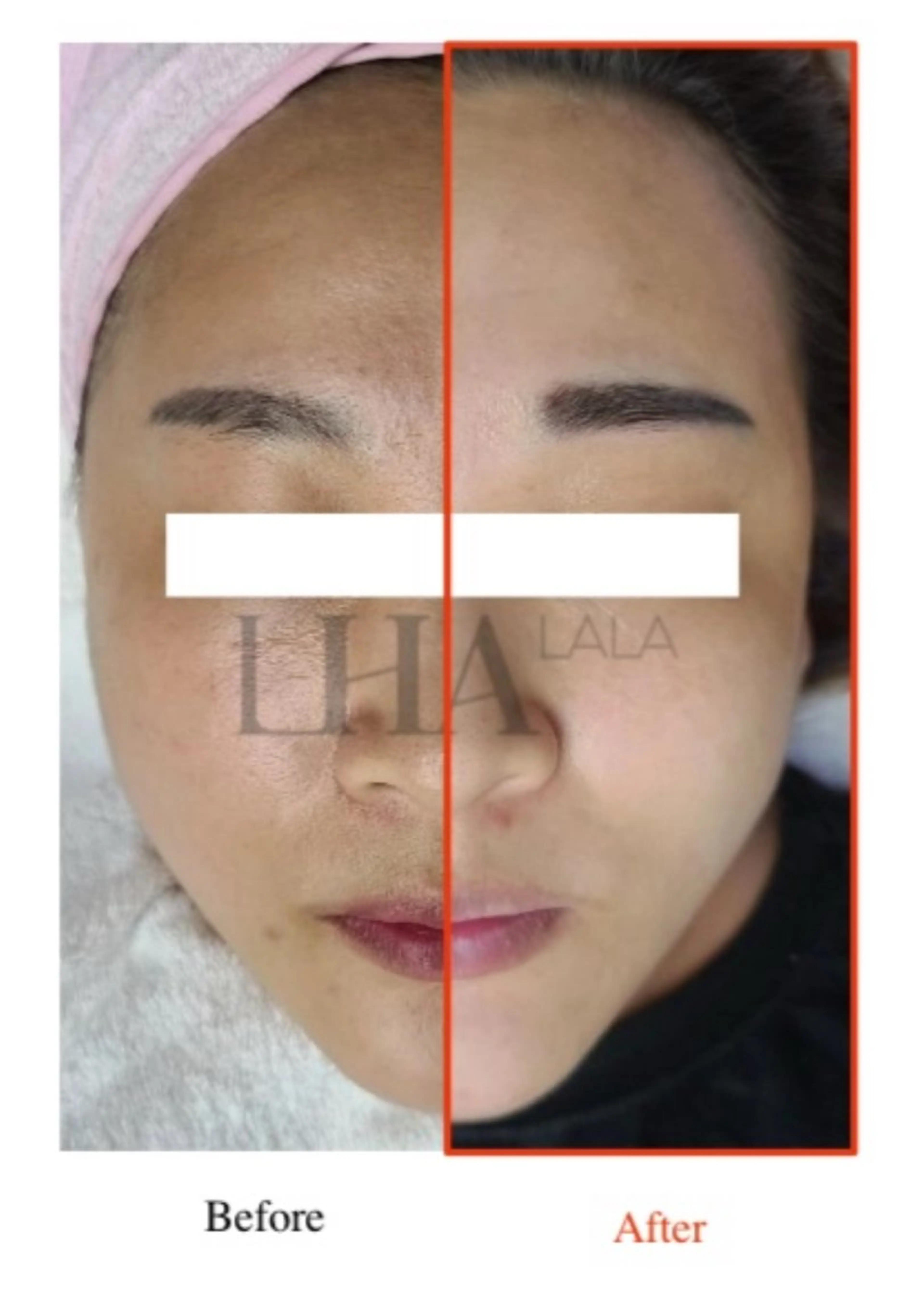 エステ ANERA Second所属・尾上 沙織のエステ・リラクイメージ