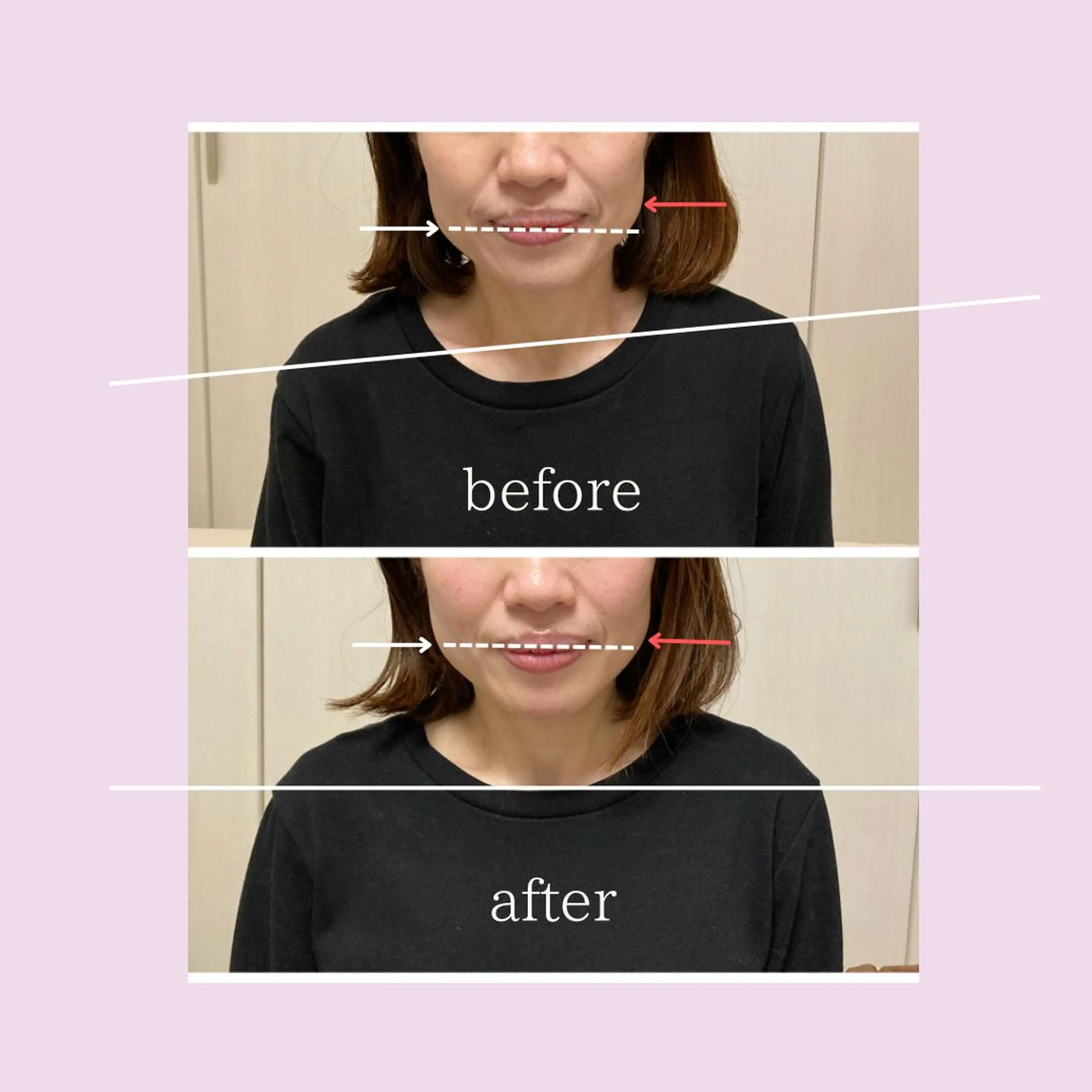 ✨全身疲労に✨ご新規様限定🔰　　　　　　　　　　美姿勢マッサージ（60分）¥10000→¥8500の写真