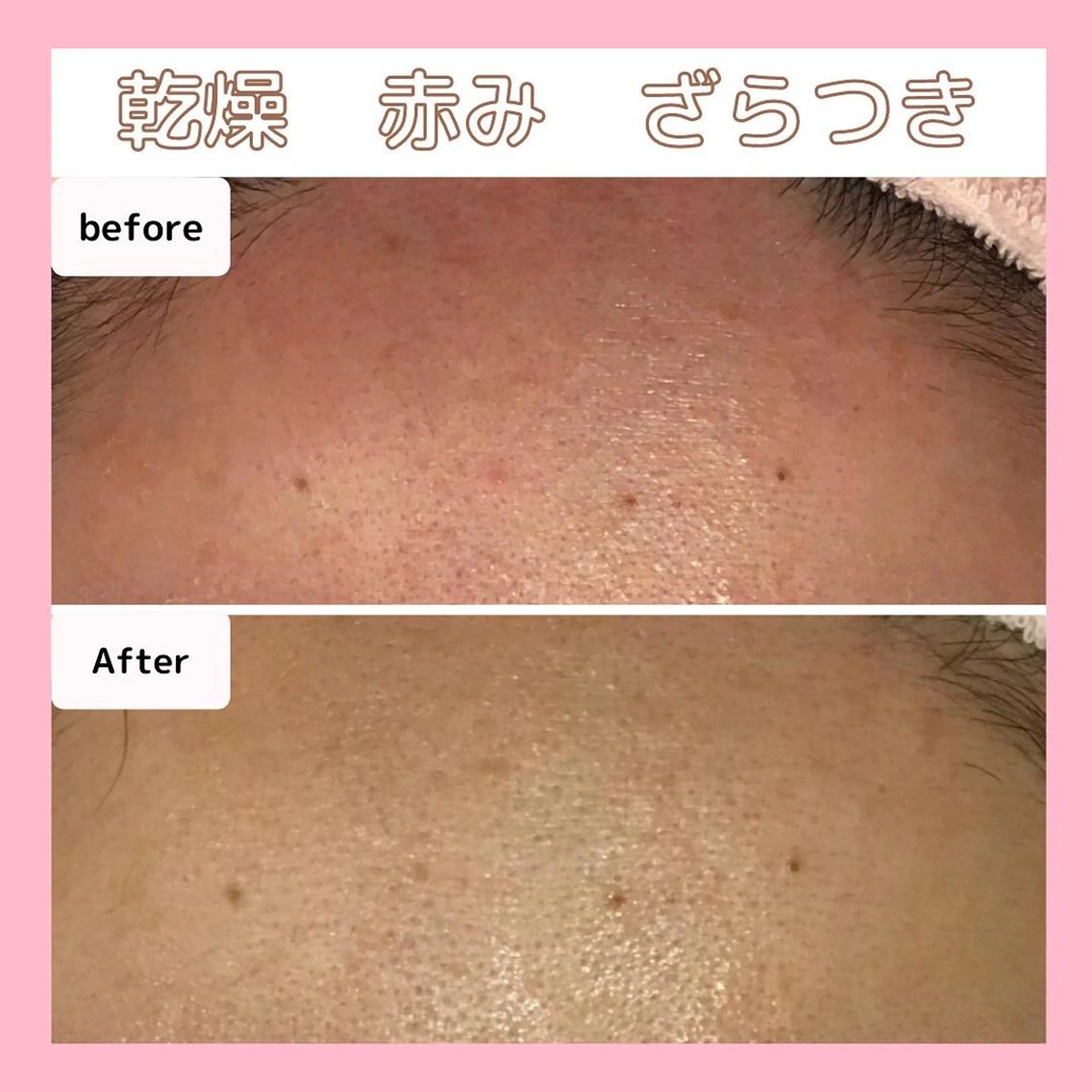 エステサロン　Sブランペタル所属・三沢市エステサロン Sブランペタルのエステ・リラクイメージ