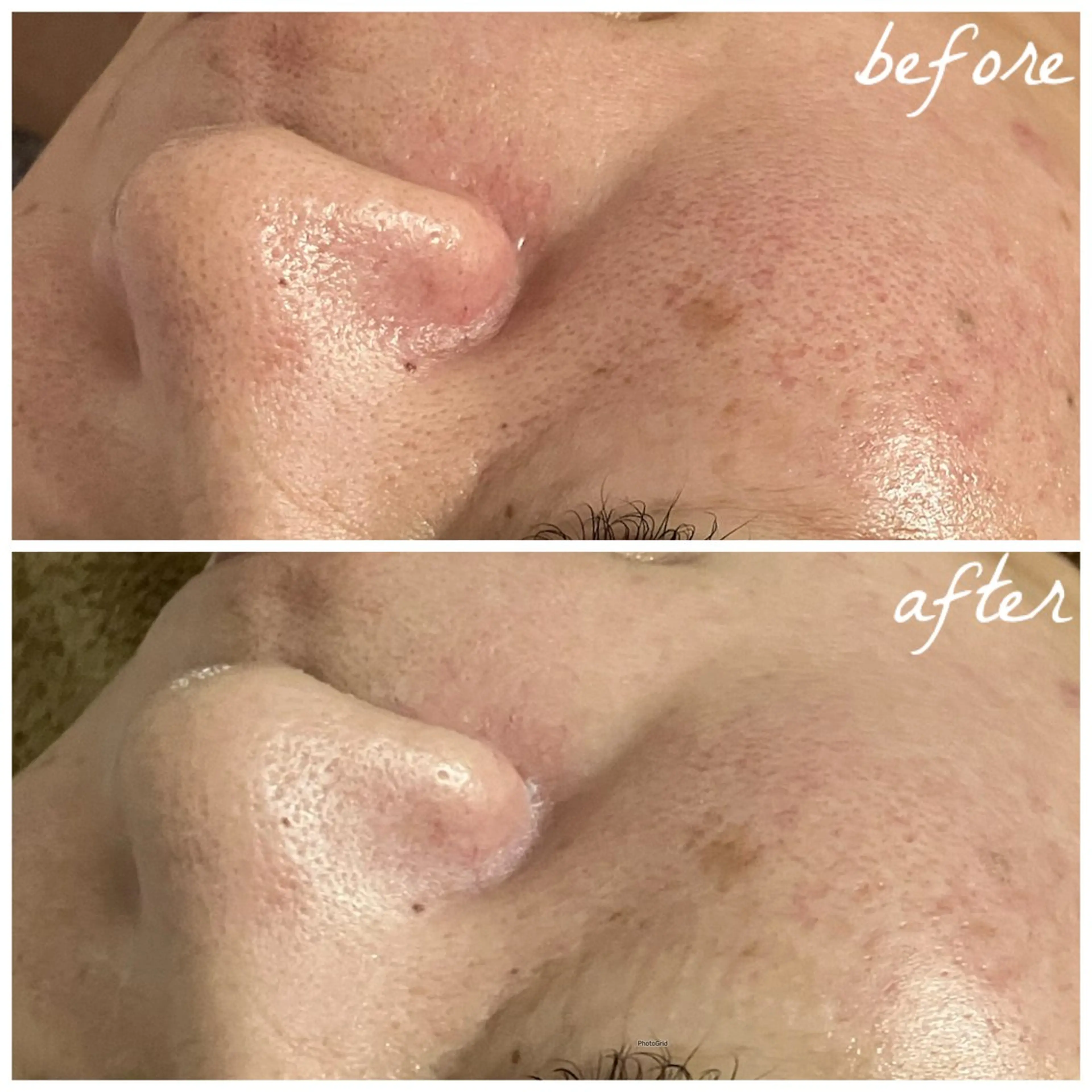 メンズ エステ メナード岐阜茜部 杉浦のエステ・リラクイメージ