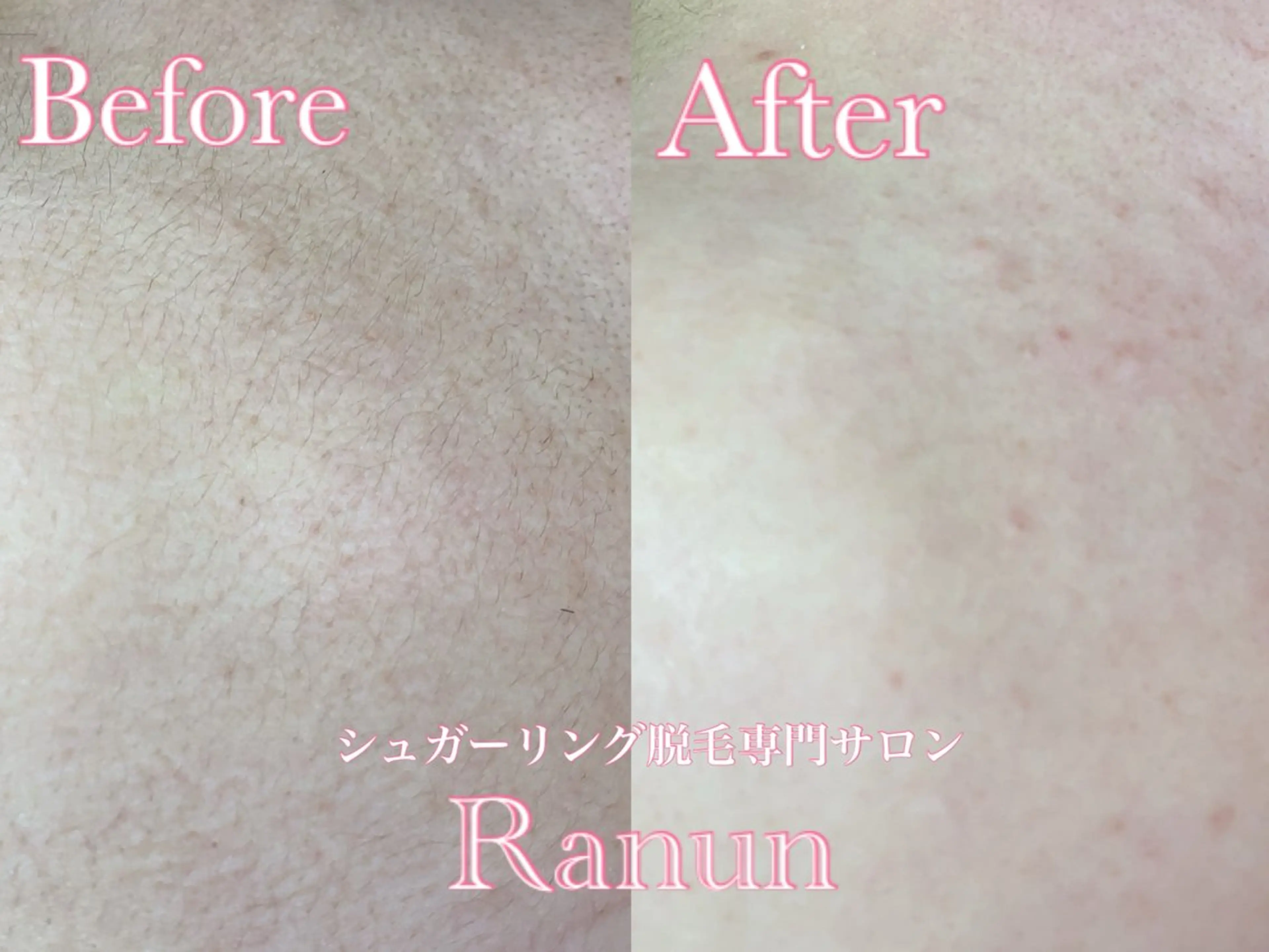 マツエク・マツパ 脱毛 シュガーリング脱毛 専門店Ranunのエステ・リラクイメージ