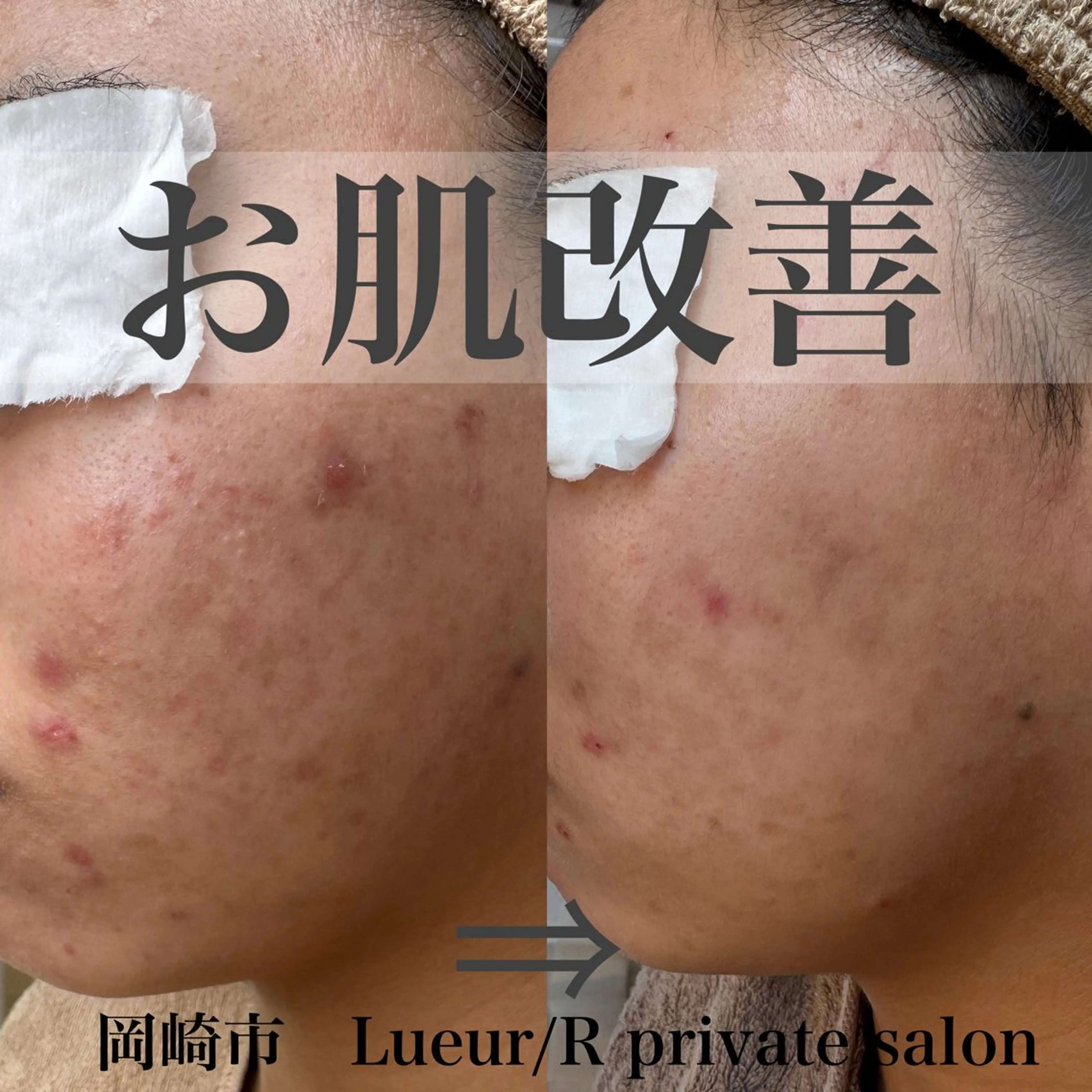 その他 大久保 里奈のエステ・リラクイメージ