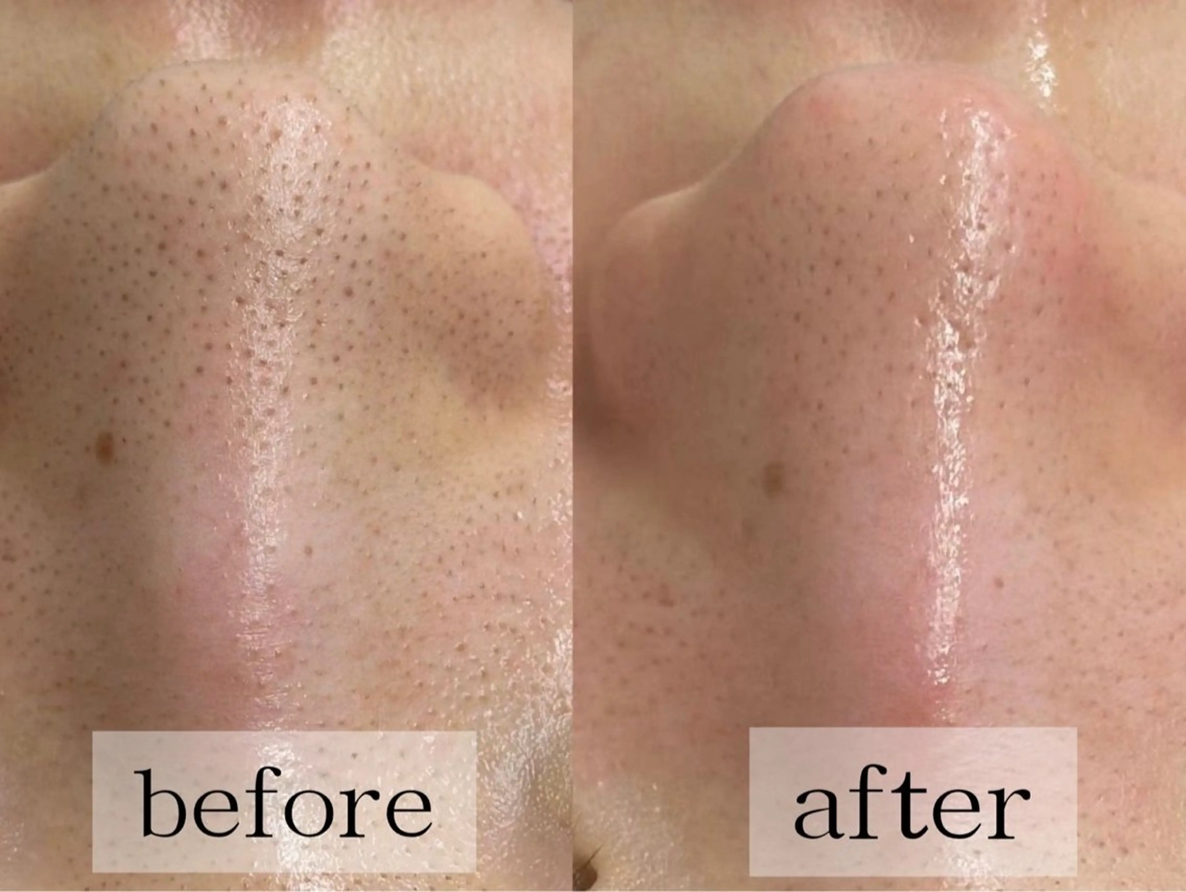 毛穴・肌質ケア専門 グランビューティーのエステ・リラクイメージ