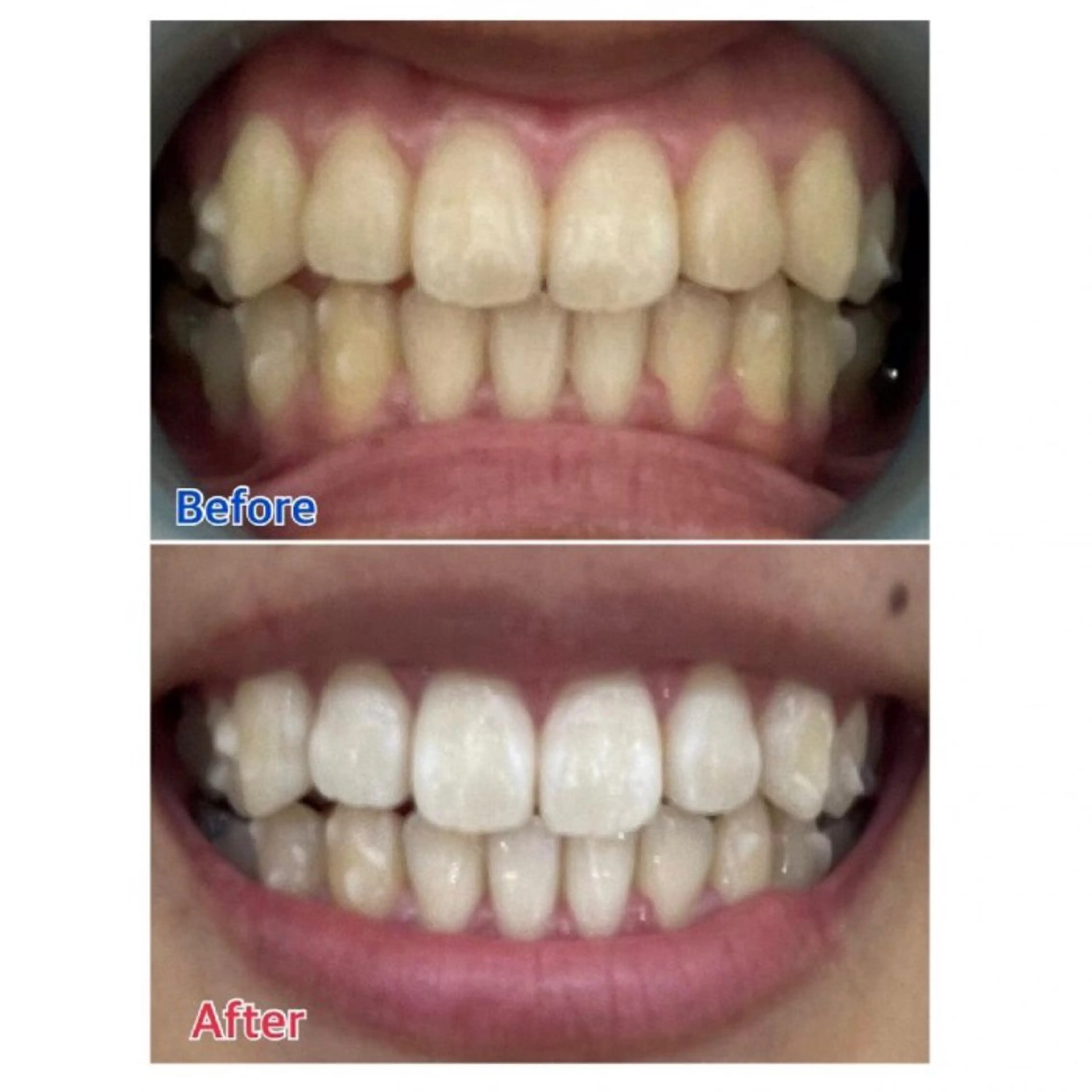 M渋谷店所属・Ｍ渋谷 ホワイトニングのエステ・リラクイメージ