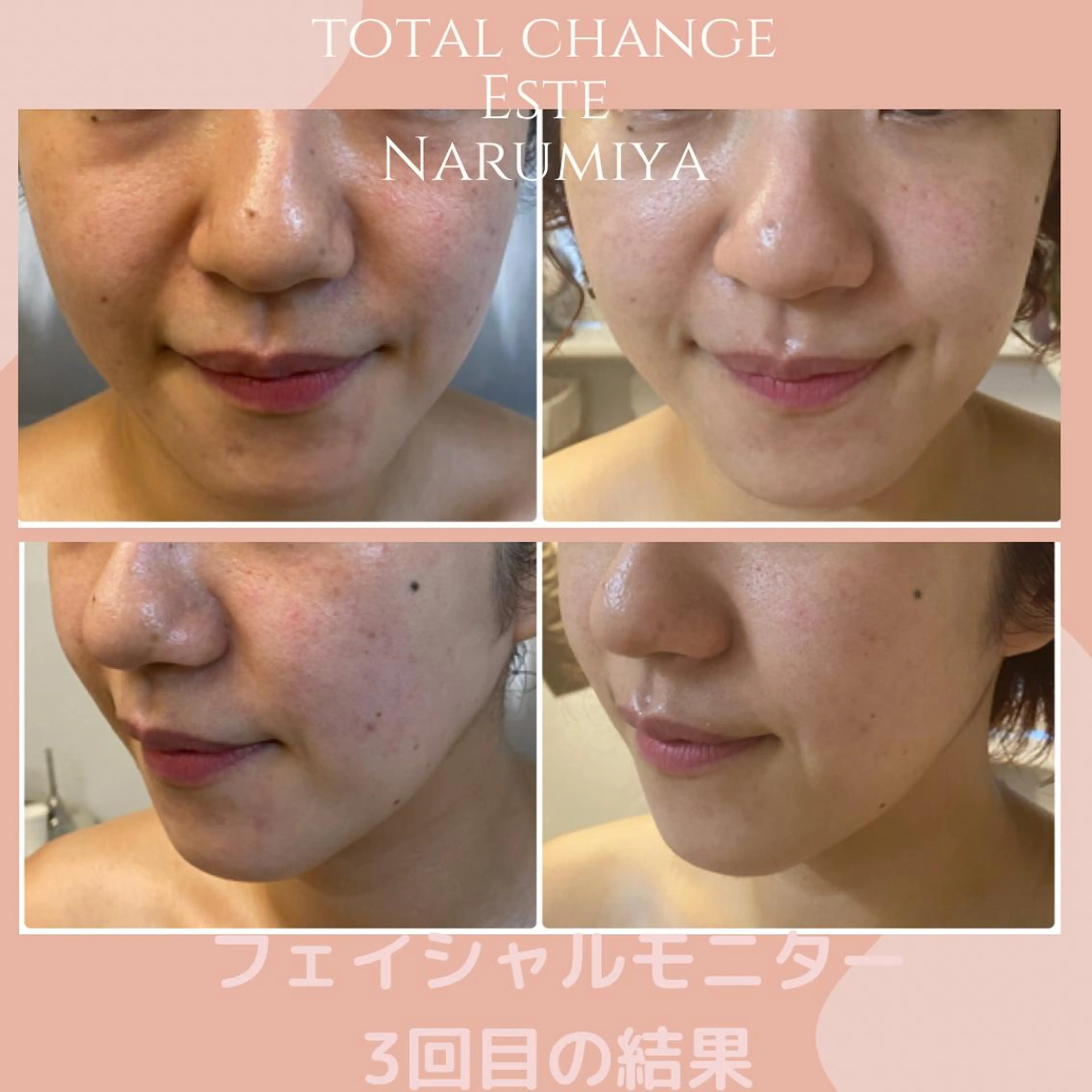 辻 佐耶のエステ・リラクイメージ