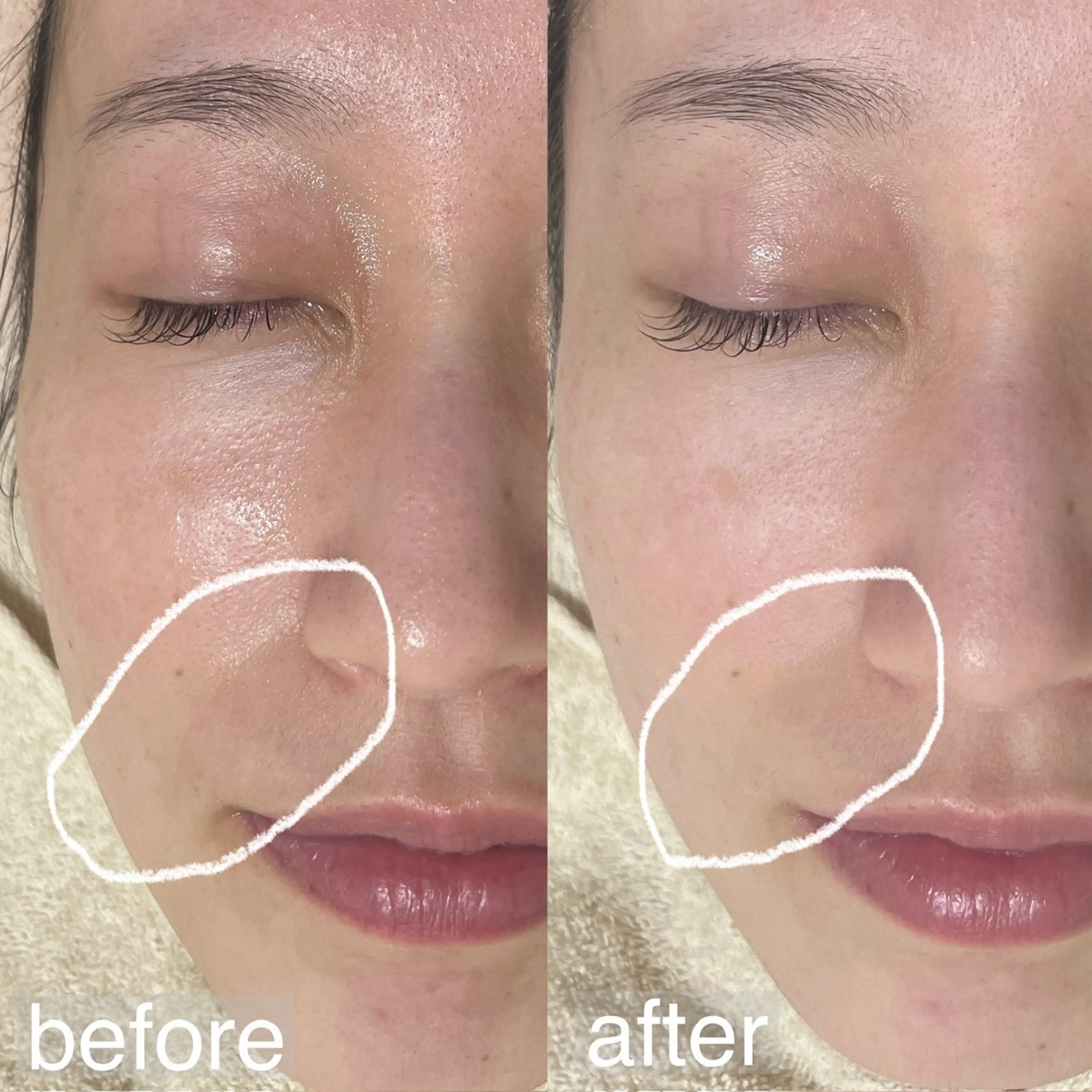 エステ アイブロウ&フェイシャルサロンa‘lm所属・WAX脱毛/肌質改善 眉毛とお肌のサロンのエステ・リラクイメージ